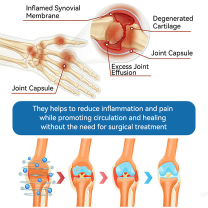 🌿FDA Approved|JOAE® BPC-157 Joint Restore Oral Liquid🦴Treats Arthritis, Neuropathy, Rheumatism, Sports Injuries & More🏆