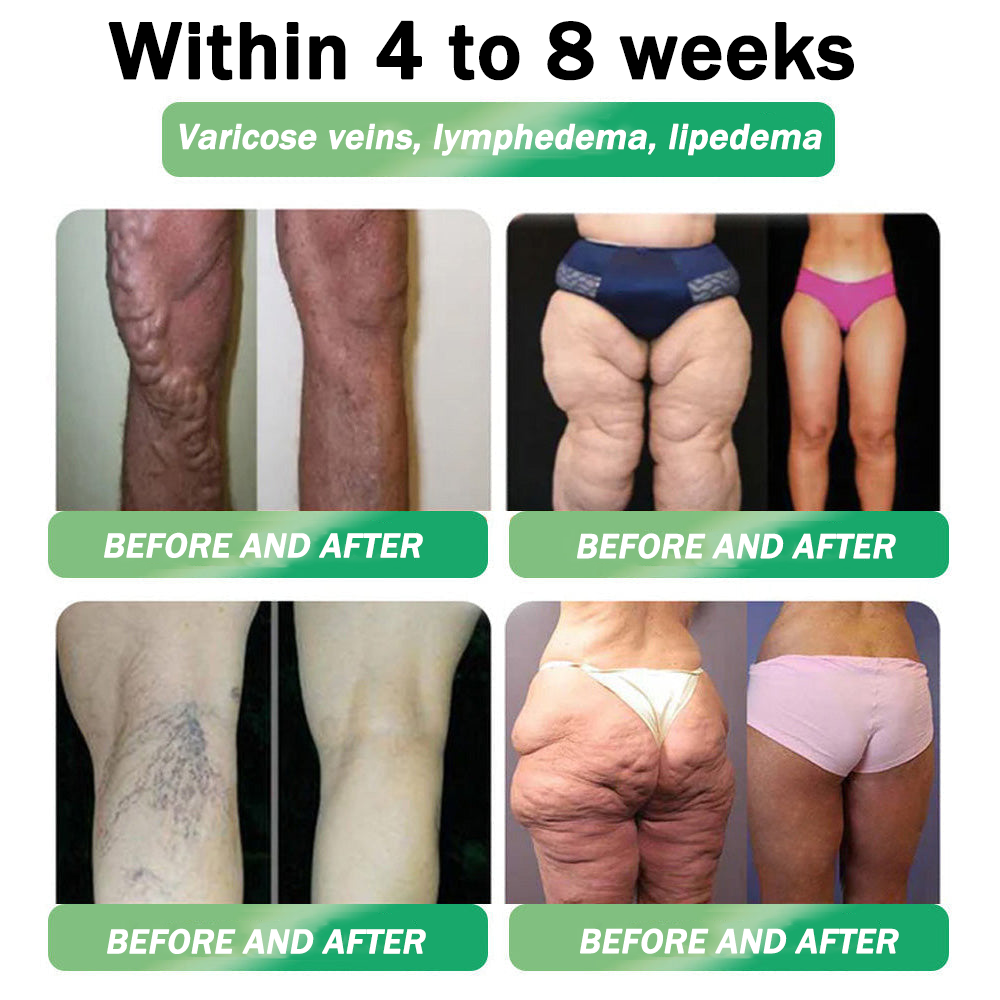 Tienda oficial | HHVB® NAD+ GLP-1 Pro ALL-IN-ONE Fit & Vital Oral Liquid (Solo una vez al día, resultados visibles en 7 días) ✅ Para obesidad, salud del corazón, diabetes, apnea del sueño, salud intestinal, articulaciones y más.