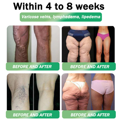 Tienda oficial | HHVB® NAD+ GLP-1 Pro ALL-IN-ONE Fit & Vital Oral Liquid (Solo una vez al día, resultados visibles en 7 días) ✅ Para obesidad, salud del corazón, diabetes, apnea del sueño, salud intestinal, articulaciones y más.