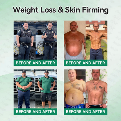 𝐎𝐟𝐟𝐢𝐜𝐢𝐚𝐥 𝐒𝐭𝐨𝐫𝐞| 🎁𝐉𝐎𝐀𝐄® 𝐆𝐋𝐏-𝟏 𝐒𝐥𝐢𝐦 & 𝐆𝐮𝐭 𝐏𝐫𝐨𝐛𝐢𝐨𝐭𝐢𝐜 𝐏𝐨𝐰𝐝𝐞𝐫 (𝐆𝐋𝐏-𝟏 × 𝐏𝐫𝐨𝐛𝐢𝐨𝐭𝐢𝐜 × 𝐀𝐂𝐕) — 𝐃𝐞𝐬𝐢𝐠𝐧𝐞𝐝 𝐟𝐨𝐫 𝐖𝐞𝐢𝐠𝐡𝐭 𝐌𝐚𝐧𝐚𝐠𝐞𝐦𝐞𝐧𝐭, 𝐆𝐮𝐭 𝐇𝐞𝐚𝐥𝐭𝐡, 𝐁𝐥𝐨𝐨𝐝 𝐒𝐮𝐠𝐚𝐫 𝐒𝐮𝐩𝐩𝐨𝐫𝐭, 𝐁𝐥𝐨𝐚𝐭𝐢𝐧𝐠 & 𝐂𝐨𝐧𝐬𝐭𝐢𝐩𝐚𝐭𝐢𝐨𝐧 𝐑𝐞𝐥𝐢𝐞𝐟, 𝐀𝐩𝐩𝐞𝐭𝐢𝐭𝐞 𝐂𝐨𝐧𝐭𝐫𝐨𝐥, 𝐈𝐦𝐦𝐮𝐧𝐢𝐭𝐲, 𝐚𝐧𝐝 𝐄𝐧𝐞𝐫𝐠𝐲 𝐁𝐨𝐨𝐬𝐭