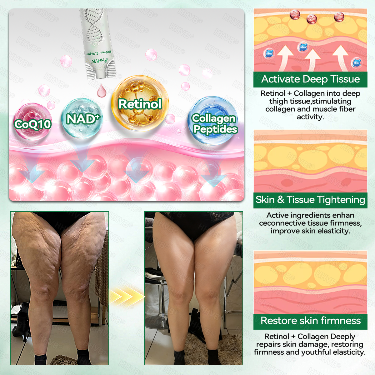 🇺🇸FDA|𝙃𝙃𝙑𝘽®𝐑𝐞𝐭𝐢𝐧𝐨𝐥 + 𝐂𝐨𝐥𝐥𝐚𝐠𝐞𝐧 𝐀𝐧𝐭𝐢-𝐖𝐫𝐢𝐧𝐤𝐥𝐞 & 𝐅𝐢𝐫𝐦𝐢𝐧𝐠 𝐒𝐞𝐫𝐮𝐦 𝐒𝐚𝐜𝐡𝐞𝐭𝐬 (𝐉𝐮𝐬𝐭 𝐨𝐧𝐜𝐞 𝐚 𝐝𝐚𝐲, 𝐯𝐢𝐬𝐢𝐛𝐥𝐞 𝐜𝐡𝐚𝐧𝐠𝐞𝐬 𝐢𝐧 𝟕 𝐝𝐚𝐲𝐬） ✅ Improves sagging skin on the face, neck, arms, abdomen, and buttocks, while reducing dark spots and discoloration