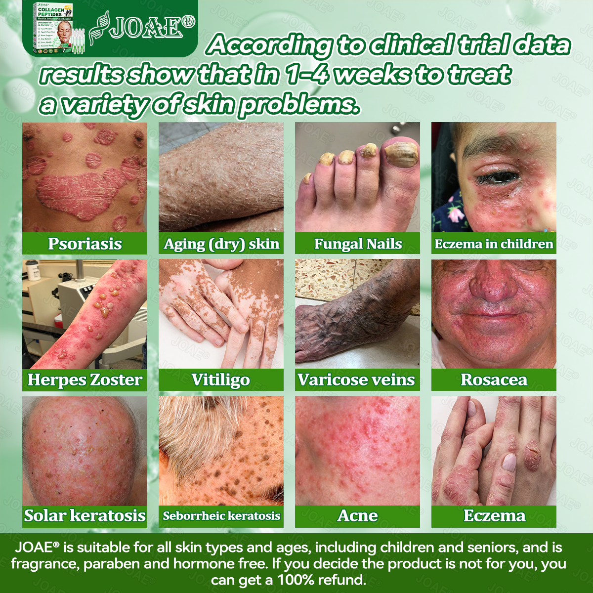 🇺🇸𝑂𝑓𝑓𝑖𝑐𝑖𝑎𝑙 𝑆𝑡𝑜𝑟𝑒 |🌿𝐉𝐎𝑨𝑬® 𝗖𝗼𝗹𝗹𝗮𝗴𝗲𝗻 𝗣𝗲𝗽𝘁𝗶𝗱𝗲𝘀 𝟲-𝗶𝗻-𝟭 𝗛𝗲𝗮𝗹𝘁𝗵 𝗦𝗼𝗹𝘂𝘁𝗶𝗼𝗻 𝗢𝗿𝗮𝗹 𝗟𝗶𝗾𝘂𝗶𝗱✅ 𝒔𝒖𝒑𝒑𝒐𝒓𝒕𝒔 𝒂𝒏𝒕𝒊-𝒂𝒈𝒊𝒏𝒈, 𝒘𝒓𝒊𝒏𝒌𝒍𝒆 𝒓𝒆𝒅𝒖𝒄𝒕𝒊𝒐𝒏, 𝒘𝒂𝒓𝒕 𝒂𝒏𝒅 𝒔𝒑𝒐𝒕 𝒓𝒆𝒎𝒐𝒗𝒂𝒍, 𝒄𝒂𝒓𝒅𝒊𝒐𝒗𝒂𝒔𝒄𝒖𝒍𝒂𝒓 𝒉𝒆𝒂𝒍𝒕𝒉, 𝒊𝒎𝒎𝒖𝒏𝒆 𝒃𝒐𝒐𝒔𝒕, 𝒈𝒖𝒕 𝒃𝒂𝒍𝒂𝒏𝒄𝒆, 𝒋𝒐𝒊𝒏𝒕 𝒄𝒂𝒓𝒆, 𝒂𝒏𝒅 𝒎𝒐𝒓𝒆.