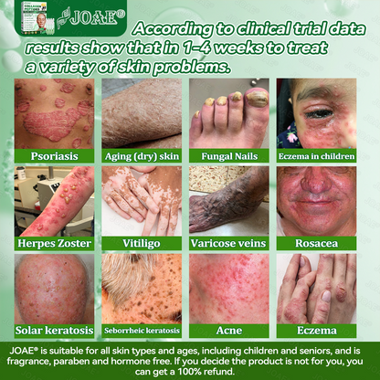 🇺🇸𝑂𝑓𝑓𝑖𝑐𝑖𝑎𝑙 𝑆𝑡𝑜𝑟𝑒 |🌿𝐉𝐎𝑨𝑬® 𝗖𝗼𝗹𝗹𝗮𝗴𝗲𝗻 𝗣𝗲𝗽𝘁𝗶𝗱𝗲𝘀 𝟲-𝗶𝗻-𝟭 𝗛𝗲𝗮𝗹𝘁𝗵 𝗦𝗼𝗹𝘂𝘁𝗶𝗼𝗻 𝗢𝗿𝗮𝗹 𝗟𝗶𝗾𝘂𝗶𝗱✅ 𝒔𝒖𝒑𝒑𝒐𝒓𝒕𝒔 𝒂𝒏𝒕𝒊-𝒂𝒈𝒊𝒏𝒈, 𝒘𝒓𝒊𝒏𝒌𝒍𝒆 𝒓𝒆𝒅𝒖𝒄𝒕𝒊𝒐𝒏, 𝒘𝒂𝒓𝒕 𝒂𝒏𝒅 𝒔𝒑𝒐𝒕 𝒓𝒆𝒎𝒐𝒗𝒂𝒍, 𝒄𝒂𝒓𝒅𝒊𝒐𝒗𝒂𝒔𝒄𝒖𝒍𝒂𝒓 𝒉𝒆𝒂𝒍𝒕𝒉, 𝒊𝒎𝒎𝒖𝒏𝒆 𝒃𝒐𝒐𝒔𝒕, 𝒈𝒖𝒕 𝒃𝒂𝒍𝒂𝒏𝒄𝒆, 𝒋𝒐𝒊𝒏𝒕 𝒄𝒂𝒓𝒆, 𝒂𝒏𝒅 𝒎𝒐𝒓𝒆.