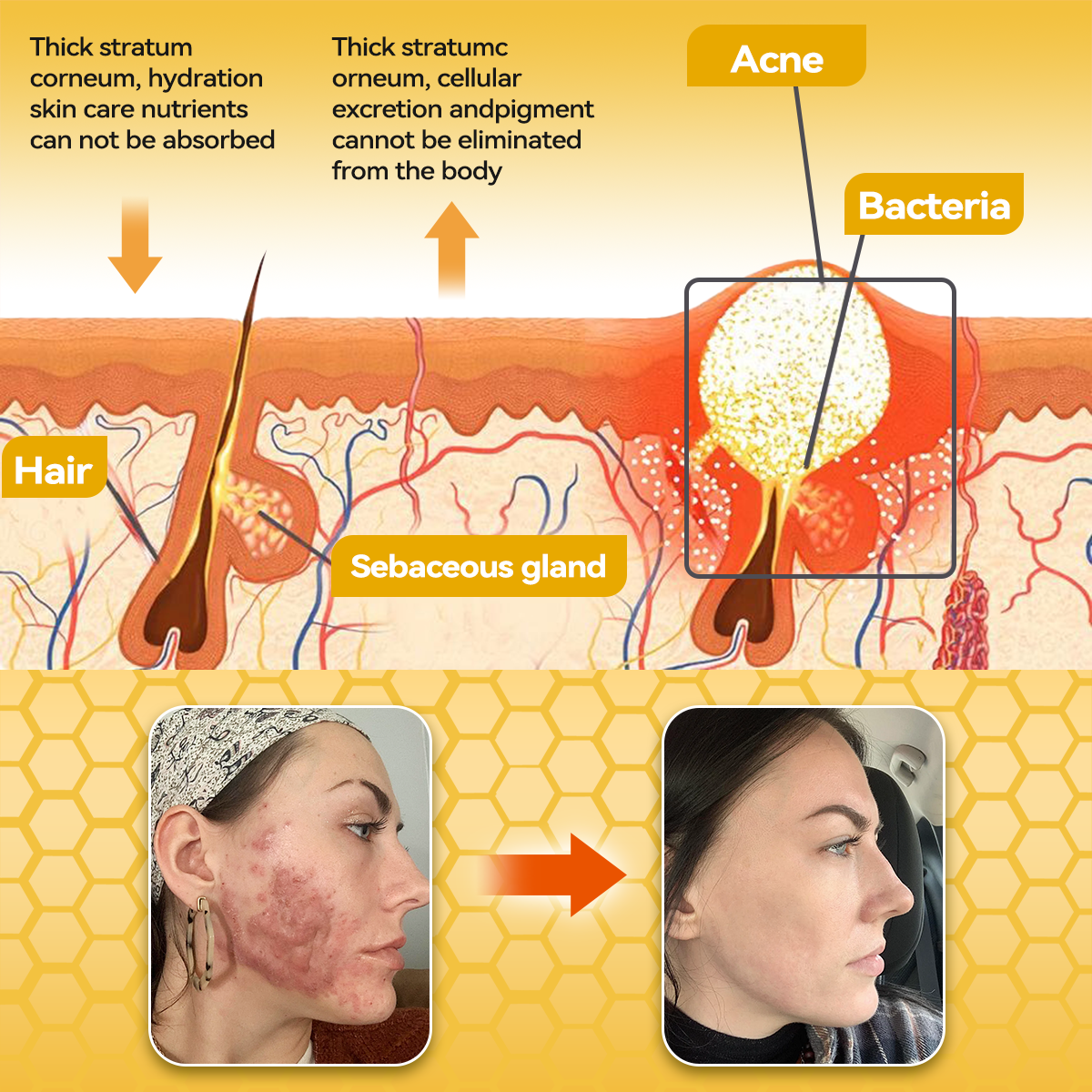 🇺🇸𝑶𝒇𝒇𝒊𝒄𝒊𝒂𝒍 𝑺𝒕𝒐𝒓𝒆|𝑺𝒂𝒃𝒂𝒙® 𝐁𝐞𝐞 𝐕𝐞𝐧𝐨𝐦 & 𝐖𝐡𝐢𝐩𝐩𝐞𝐝 𝐓𝐚𝐥𝐥𝐨𝐰 𝐁𝐚𝐥𝐦 Skin Repair Cream (𝐉𝐮𝐬𝐭 𝐨𝐧𝐜𝐞 𝐚 𝐝𝐚𝐲, 𝐯𝐢𝐬𝐢𝐛𝐥𝐞 𝐜𝐡𝐚𝐧𝐠𝐞𝐬 𝐢𝐧 𝟕 𝐝𝐚𝐲𝐬） ✅ Targets Age Spots, Wrinkles, Eczema, Redness, Stretch Marks, and Even Joint Issues.