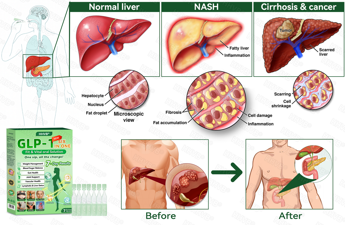 𝑶𝒇𝒇𝒊𝒄𝒊𝒂𝒍 𝑺𝒕𝒐𝒓𝒆 | 𝗛𝗛𝙑𝐵®🌈𝐺𝐿𝑃-𝟏  SIX-𝑰𝑵-𝑶𝑵𝑬 Fit&Vital 𝑶𝒓𝒂𝒍 𝑳𝒊𝒒𝒖𝒊𝒅  (𝐉𝐮𝐬𝐭 𝐨𝐧𝐜𝐞 𝐚 𝐝𝐚𝐲, 𝐯𝐢𝐬𝐢𝐛𝐥𝐞 𝐜𝐡𝐚𝐧𝐠𝐞𝐬 𝐢𝐧 𝟕 𝐝𝐚𝐲𝐬） ✅ 𝐅𝐨𝐫 𝐨𝐛𝐞𝐬𝐢𝐭𝐲, 𝐜𝐚𝐫𝐝𝐢𝐨𝐯𝐚𝐬𝐜𝐮𝐥𝐚𝐫 𝐡𝐞𝐚𝐥𝐭𝐡, 𝐝𝐢𝐚𝐛𝐞𝐭𝐞𝐬, 𝐬𝐥𝐞𝐞𝐩 𝐚𝐩𝐧𝐞𝐚, 𝐆𝐮𝐭 𝐇𝐞𝐚𝐥𝐭𝐡, 𝐣𝐨𝐢𝐧𝐭 𝐢𝐬𝐬𝐮𝐞𝐬, 𝐚𝐧𝐝 𝐦𝐨𝐫𝐞