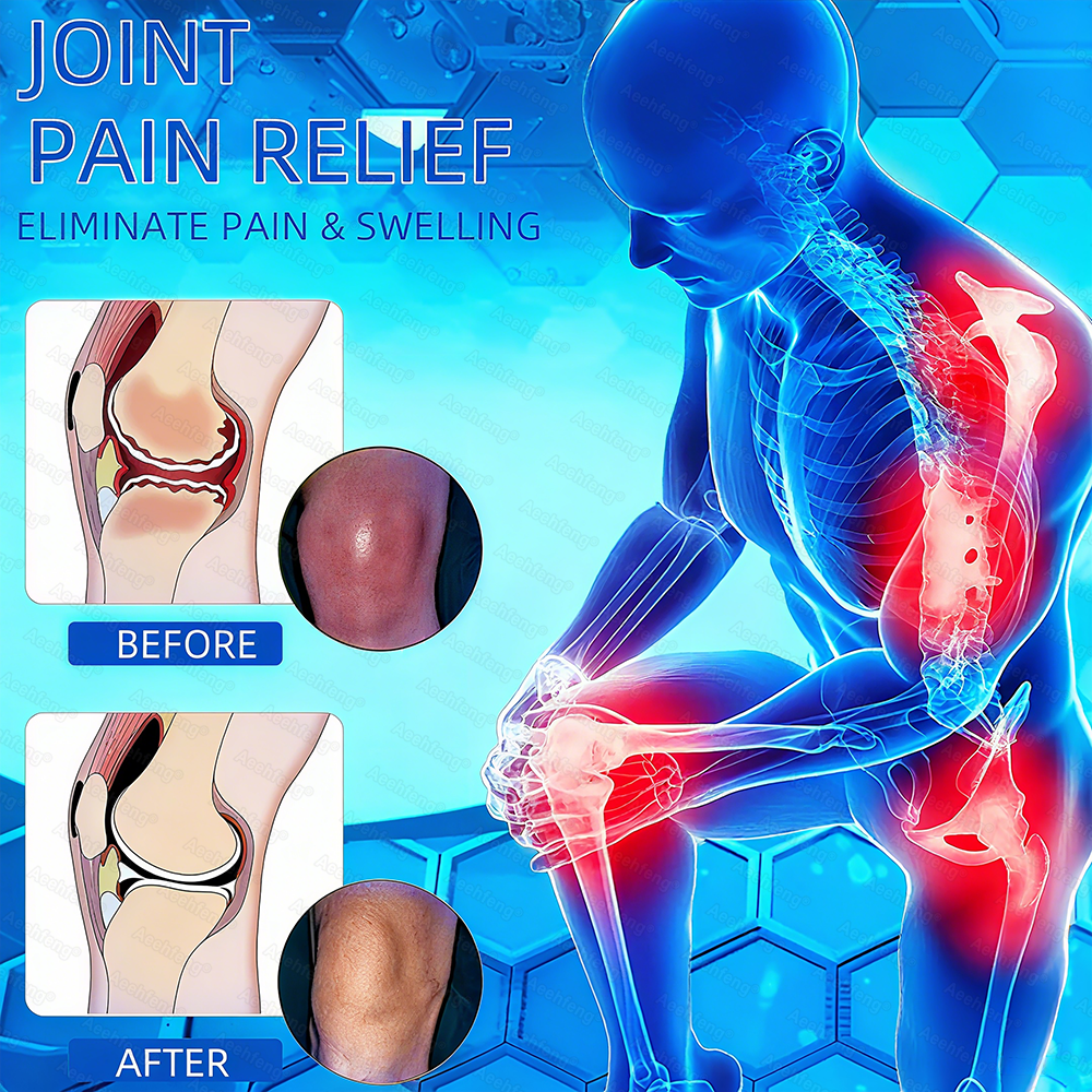 𝐀𝐞𝐞𝙝𝙛𝗲𝗻𝗴® BPC-157 Joint Healing Cream🦴Treats Arthritis, Neuropathy, Rheumatism, Sports Injuries & More 🤍