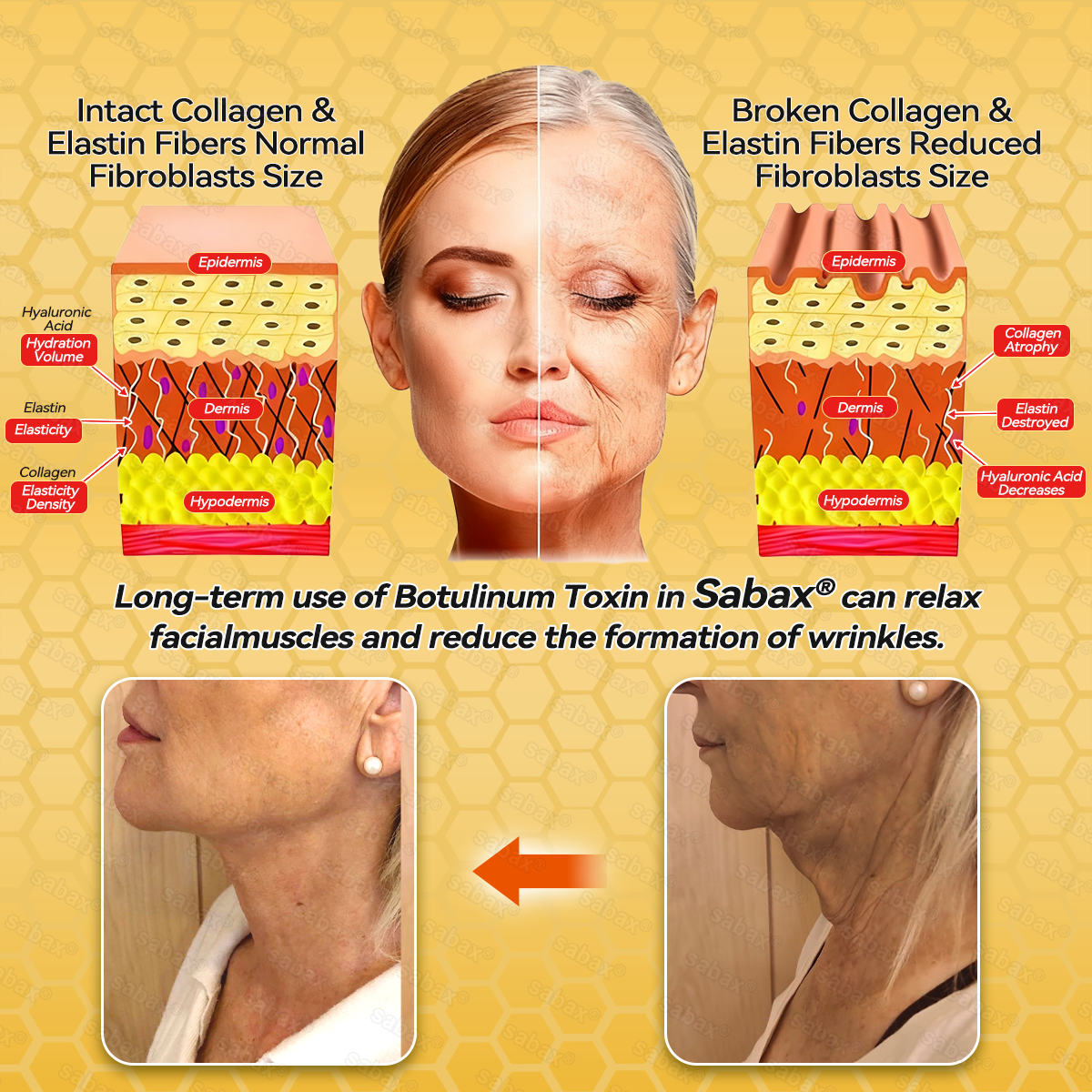 🇺🇸𝑶𝒇𝒇𝒊𝒄𝒊𝒂𝒍 𝑺𝒕𝒐𝒓𝒆|𝑺𝒂𝒃𝒂𝒙® 𝐁𝐞𝐞 𝐕𝐞𝐧𝐨𝐦 & 𝐖𝐡𝐢𝐩𝐩𝐞𝐝 𝐓𝐚𝐥𝐥𝐨𝐰 𝐁𝐚𝐥𝐦 Skin Repair Cream (𝐉𝐮𝐬𝐭 𝐨𝐧𝐜𝐞 𝐚 𝐝𝐚𝐲, 𝐯𝐢𝐬𝐢𝐛𝐥𝐞 𝐜𝐡𝐚𝐧𝐠𝐞𝐬 𝐢𝐧 𝟕 𝐝𝐚𝐲𝐬） ✅ Targets Age Spots, Wrinkles, Eczema, Redness, Stretch Marks, and Even Joint Issues.