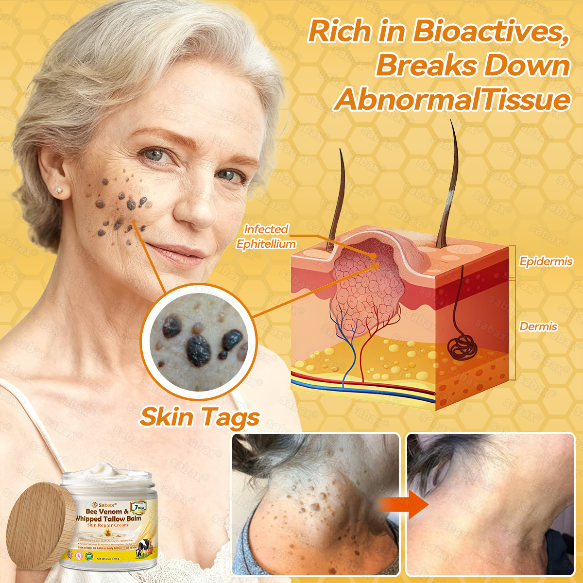 🇺🇸𝑶𝒇𝒇𝒊𝒄𝒊𝒂𝒍 𝑺𝒕𝒐𝒓𝒆|𝑺𝒂𝒃𝒂𝒙® 𝐁𝐞𝐞 𝐕𝐞𝐧𝐨𝐦 & 𝐖𝐡𝐢𝐩𝐩𝐞𝐝 𝐓𝐚𝐥𝐥𝐨𝐰 𝐁𝐚𝐥𝐦 Skin Repair Cream (𝐉𝐮𝐬𝐭 𝐨𝐧𝐜𝐞 𝐚 𝐝𝐚𝐲, 𝐯𝐢𝐬𝐢𝐛𝐥𝐞 𝐜𝐡𝐚𝐧𝐠𝐞𝐬 𝐢𝐧 𝟕 𝐝𝐚𝐲𝐬） ✅ Targets Age Spots, Wrinkles, Eczema, Redness, Stretch Marks, and Even Joint Issues.