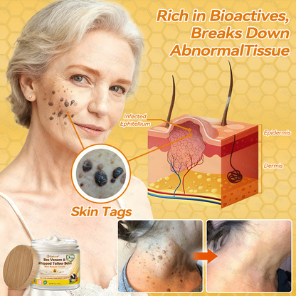 🇺🇸𝑶𝒇𝒇𝒊𝒄𝒊𝒂𝒍 𝑺𝒕𝒐𝒓𝒆|𝑺𝒂𝒃𝒂𝒙® 𝐁𝐞𝐞 𝐕𝐞𝐧𝐨𝐦 & 𝐖𝐡𝐢𝐩𝐩𝐞𝐝 𝐓𝐚𝐥𝐥𝐨𝐰 𝐁𝐚𝐥𝐦 Skin Repair Cream (𝐉𝐮𝐬𝐭 𝐨𝐧𝐜𝐞 𝐚 𝐝𝐚𝐲, 𝐯𝐢𝐬𝐢𝐛𝐥𝐞 𝐜𝐡𝐚𝐧𝐠𝐞𝐬 𝐢𝐧 𝟕 𝐝𝐚𝐲𝐬） ✅ Targets Age Spots, Wrinkles, Eczema, Redness, Stretch Marks, and Even Joint Issues.