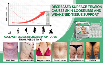 🇺🇸FDA|𝙃𝙃𝙑𝘽®𝐑𝐞𝐭𝐢𝐧𝐨𝐥 + 𝐂𝐨𝐥𝐥𝐚𝐠𝐞𝐧 𝐀𝐧𝐭𝐢-𝐖𝐫𝐢𝐧𝐤𝐥𝐞 & 𝐅𝐢𝐫𝐦𝐢𝐧𝐠 𝐒𝐞𝐫𝐮𝐦 𝐒𝐚𝐜𝐡𝐞𝐭𝐬 (𝐉𝐮𝐬𝐭 𝐨𝐧𝐜𝐞 𝐚 𝐝𝐚𝐲, 𝐯𝐢𝐬𝐢𝐛𝐥𝐞 𝐜𝐡𝐚𝐧𝐠𝐞𝐬 𝐢𝐧 𝟕 𝐝𝐚𝐲𝐬） ✅ Improves sagging skin on the face, neck, arms, abdomen, and buttocks, while reducing dark spots and discoloration