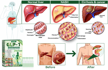 𝑶𝒇𝒇𝒊𝒄𝒊𝒂𝒍 𝑺𝒕𝒐𝒓𝒆 | 𝗛𝗛𝙑𝐵®🌈𝐺𝐿𝑃-𝟏  ALL-𝑰𝑵-𝑶𝑵𝑬 Fit&Vital 𝑶𝒓𝒂𝒍 𝑳𝒊𝒒𝒖𝒊𝒅  (𝐉𝐮𝐬𝐭 𝐨𝐧𝐜𝐞 𝐚 𝐝𝐚𝐲, 𝐯𝐢𝐬𝐢𝐛𝐥𝐞 𝐜𝐡𝐚𝐧𝐠𝐞𝐬 𝐢𝐧 𝟕 𝐝𝐚𝐲𝐬） ✅ 𝐅𝐨𝐫 𝐨𝐛𝐞𝐬𝐢𝐭𝐲, 𝐜𝐚𝐫𝐝𝐢𝐨𝐯𝐚𝐬𝐜𝐮𝐥𝐚𝐫 𝐡𝐞𝐚𝐥𝐭𝐡, 𝐝𝐢𝐚𝐛𝐞𝐭𝐞𝐬, 𝐬𝐥𝐞𝐞𝐩 𝐚𝐩𝐧𝐞𝐚, 𝐆𝐮𝐭 𝐇𝐞𝐚𝐥𝐭𝐡, 𝐣𝐨𝐢𝐧𝐭 𝐢𝐬𝐬𝐮𝐞𝐬, 𝐚𝐧𝐝 𝐦𝐨𝐫𝐞