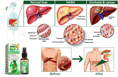 𝑶𝒇𝒇𝒊𝒄𝒊𝒂𝒍 𝑺𝒕𝒐𝒓𝒆 | 𝐇𝐇𝖵𝘽® 𝐺𝐿𝑃-𝟏  All-𝒊𝒏-𝑶𝒏𝒆 Nano Fast-Absorb Oral Spray  (𝐉𝐮𝐬𝐭 𝐨𝐧𝐜𝐞 𝐚 𝐝𝐚𝐲, 𝐯𝐢𝐬𝐢𝐛𝐥𝐞 𝐜𝐡𝐚𝐧𝐠𝐞𝐬 𝐢𝐧 𝟕 𝐝𝐚𝐲𝐬） ✅ 𝐅𝐨𝐫 𝐨𝐛𝐞𝐬𝐢𝐭𝐲, 𝐜𝐚𝐫𝐝𝐢𝐨𝐯𝐚𝐬𝐜𝐮𝐥𝐚𝐫 𝐡𝐞𝐚𝐥𝐭𝐡, 𝐝𝐢𝐚𝐛𝐞𝐭𝐞𝐬, 𝐬𝐥𝐞𝐞𝐩 𝐚𝐩𝐧𝐞𝐚, 𝐆𝐮𝐭 𝐇𝐞𝐚𝐥𝐭𝐡, 𝐣𝐨𝐢𝐧𝐭 𝐢𝐬𝐬𝐮𝐞𝐬, 𝐚𝐧𝐝 𝐦𝐨𝐫𝐞