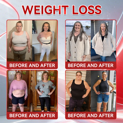 🇺🇸𝑶𝒇𝒇𝒊𝒄𝒊𝒂𝒍 𝑺𝒕𝒐𝒓𝒆𝑰𝐻𝐻𝑉𝐵®🌿𝑮𝑳𝑷-1+𝑪𝒐𝒍𝒍𝒂𝒈𝒆𝒏 𝑷𝒆𝒑𝒕𝒊𝒅𝒆𝒔 𝑾𝒆𝒊𝒈𝒉𝒕 𝑳𝒐𝒔𝒔&𝑭𝒊𝒓𝒎𝒊𝒏𝒈 𝑶𝒓𝒂𝒍 𝑺𝒐𝒍𝒖𝒕𝒊𝒐𝒏 𝒘𝒊𝒕𝒉 🔥𝑪𝒐𝒍𝒍𝒂𝒈𝒆𝒏 𝑷𝒆𝒑𝒕𝒊𝒅𝒆𝒔 & 𝑴𝒂𝒕𝒓𝒊𝒙𝒚𝒍 3000 𝒉𝒆𝒍𝒑𝒔 𝒕𝒂𝒓𝒈𝒆𝒕 ✅𝒐𝒃𝒆𝒔𝒊𝒕𝒚, 𝒇𝒊𝒓𝒎𝒔 𝒔𝒌𝒊𝒏,𝒄𝒂𝒓𝒅𝒊𝒐𝒗𝒂𝒔𝒄𝒖𝒍𝒂𝒓 𝒅𝒊𝒔𝒆𝒂𝒔𝒆, 𝒅𝒊𝒂𝒃𝒆𝒕𝒆𝒔, 𝒔𝒍𝒆𝒆𝒑 𝒂𝒑𝒏𝒆𝒂, 𝒋𝒐𝒊𝒏𝒕 𝒑𝒓𝒐𝒃𝒍𝒆𝒎𝒔, 𝒂𝒏𝒅 𝒎𝒐𝒓𝒆,