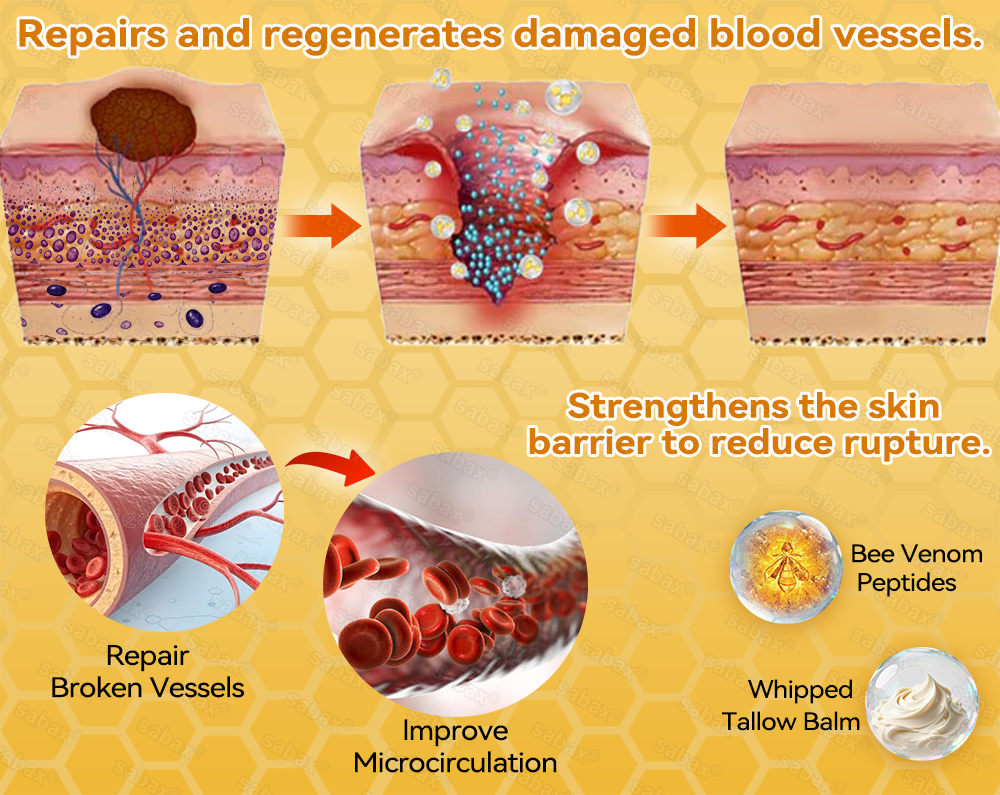 🇺🇸𝑶𝒇𝒇𝒊𝒄𝒊𝒂𝒍 𝑺𝒕𝒐𝒓𝒆|𝑺𝒂𝒃𝒂𝒙® 𝐁𝐞𝐞 𝐕𝐞𝐧𝐨𝐦 & 𝐖𝐡𝐢𝐩𝐩𝐞𝐝 𝐓𝐚𝐥𝐥𝐨𝐰 𝐁𝐚𝐥𝐦 Skin Repair Cream (𝐉𝐮𝐬𝐭 𝐨𝐧𝐜𝐞 𝐚 𝐝𝐚𝐲, 𝐯𝐢𝐬𝐢𝐛𝐥𝐞 𝐜𝐡𝐚𝐧𝐠𝐞𝐬 𝐢𝐧 𝟕 𝐝𝐚𝐲𝐬） ✅ Targets Age Spots, Wrinkles, Eczema, Redness, Stretch Marks, and Even Joint Issues.