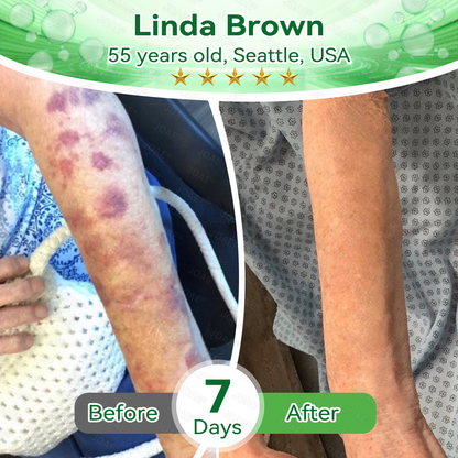 🇺🇸𝑂𝑓𝑓𝑖𝑐𝑖𝑎𝑙 𝑆𝑡𝑜𝑟𝑒 |🌿𝐉𝐎𝑨𝑬® 𝗖𝗼𝗹𝗹𝗮𝗴𝗲𝗻 𝗣𝗲𝗽𝘁𝗶𝗱𝗲𝘀 𝟲-𝗶𝗻-𝟭 𝗛𝗲𝗮𝗹𝘁𝗵 𝗦𝗼𝗹𝘂𝘁𝗶𝗼𝗻 𝗢𝗿𝗮𝗹 𝗟𝗶𝗾𝘂𝗶𝗱✅ 𝒔𝒖𝒑𝒑𝒐𝒓𝒕𝒔 𝒂𝒏𝒕𝒊-𝒂𝒈𝒊𝒏𝒈, 𝒘𝒓𝒊𝒏𝒌𝒍𝒆 𝒓𝒆𝒅𝒖𝒄𝒕𝒊𝒐𝒏, 𝒘𝒂𝒓𝒕 𝒂𝒏𝒅 𝒔𝒑𝒐𝒕 𝒓𝒆𝒎𝒐𝒗𝒂𝒍, 𝒄𝒂𝒓𝒅𝒊𝒐𝒗𝒂𝒔𝒄𝒖𝒍𝒂𝒓 𝒉𝒆𝒂𝒍𝒕𝒉, 𝒊𝒎𝒎𝒖𝒏𝒆 𝒃𝒐𝒐𝒔𝒕, 𝒈𝒖𝒕 𝒃𝒂𝒍𝒂𝒏𝒄𝒆, 𝒋𝒐𝒊𝒏𝒕 𝒄𝒂𝒓𝒆, 𝒂𝒏𝒅 𝒎𝒐𝒓𝒆.