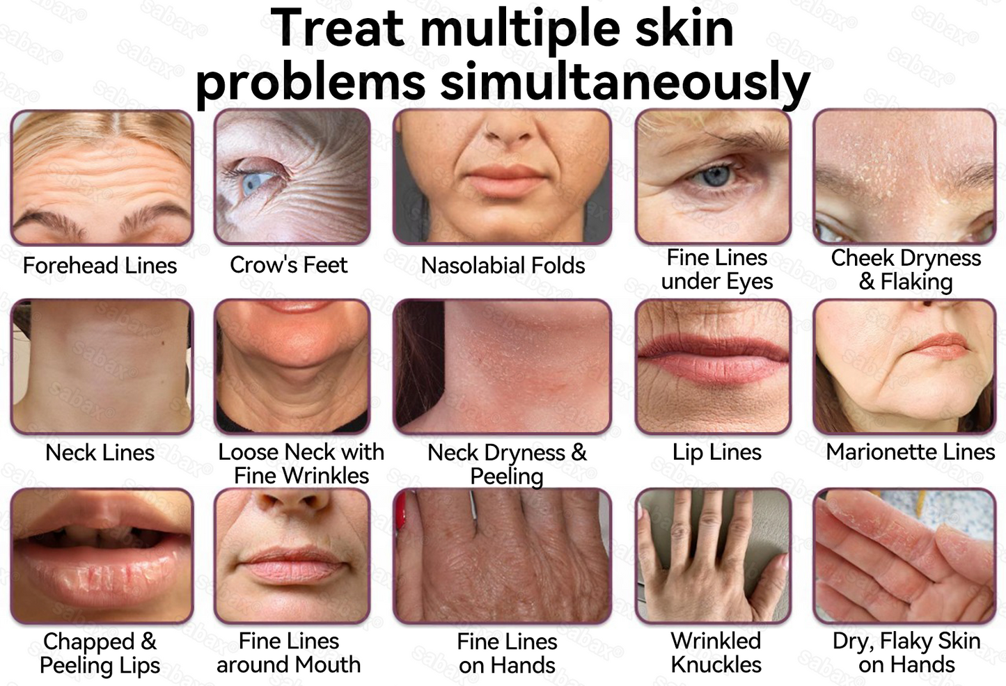 🇺🇸𝑶𝒇𝒇𝒊𝒄𝒊𝒂𝒍 𝑺𝒕𝒐𝒓𝒆|𝑺𝒂𝒃𝒂𝒙® 𝐁𝐞𝐞 𝐕𝐞𝐧𝐨𝐦 & 𝐖𝐡𝐢𝐩𝐩𝐞𝐝 𝐓𝐚𝐥𝐥𝐨𝐰 𝐁𝐚𝐥𝐦 Skin Repair Cream (𝐉𝐮𝐬𝐭 𝐨𝐧𝐜𝐞 𝐚 𝐝𝐚𝐲, 𝐯𝐢𝐬𝐢𝐛𝐥𝐞 𝐜𝐡𝐚𝐧𝐠𝐞𝐬 𝐢𝐧 𝟕 𝐝𝐚𝐲𝐬） ✅ Targets Age Spots, Wrinkles, Eczema, Redness, Stretch Marks, and Even Joint Issues.