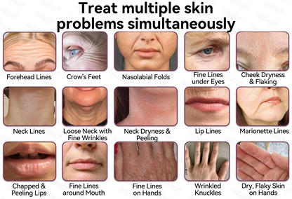 🇺🇸𝑶𝒇𝒇𝒊𝒄𝒊𝒂𝒍 𝑺𝒕𝒐𝒓𝒆|𝑺𝒂𝒃𝒂𝒙® 𝐁𝐞𝐞 𝐕𝐞𝐧𝐨𝐦 & 𝐖𝐡𝐢𝐩𝐩𝐞𝐝 𝐓𝐚𝐥𝐥𝐨𝐰 𝐁𝐚𝐥𝐦 Skin Repair Cream (𝐉𝐮𝐬𝐭 𝐨𝐧𝐜𝐞 𝐚 𝐝𝐚𝐲, 𝐯𝐢𝐬𝐢𝐛𝐥𝐞 𝐜𝐡𝐚𝐧𝐠𝐞𝐬 𝐢𝐧 𝟕 𝐝𝐚𝐲𝐬） ✅ Targets Age Spots, Wrinkles, Eczema, Redness, Stretch Marks, and Even Joint Issues.