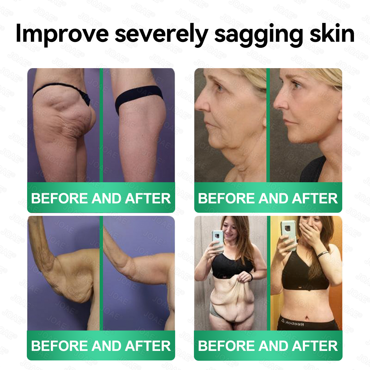 🇺🇸𝑂𝑓𝑓𝑖𝑐𝑖𝑎𝑙 𝑆𝑡𝑜𝑟𝑒 |🌿𝐉𝐎𝑨𝑬® 𝗖𝗼𝗹𝗹𝗮𝗴𝗲𝗻 𝗣𝗲𝗽𝘁𝗶𝗱𝗲𝘀 𝟲-𝗶𝗻-𝟭 𝗛𝗲𝗮𝗹𝘁𝗵 𝗦𝗼𝗹𝘂𝘁𝗶𝗼𝗻 𝗢𝗿𝗮𝗹 𝗟𝗶𝗾𝘂𝗶𝗱✅ 𝒔𝒖𝒑𝒑𝒐𝒓𝒕𝒔 𝒂𝒏𝒕𝒊-𝒂𝒈𝒊𝒏𝒈, 𝒘𝒓𝒊𝒏𝒌𝒍𝒆 𝒓𝒆𝒅𝒖𝒄𝒕𝒊𝒐𝒏, 𝒘𝒂𝒓𝒕 𝒂𝒏𝒅 𝒔𝒑𝒐𝒕 𝒓𝒆𝒎𝒐𝒗𝒂𝒍, 𝒄𝒂𝒓𝒅𝒊𝒐𝒗𝒂𝒔𝒄𝒖𝒍𝒂𝒓 𝒉𝒆𝒂𝒍𝒕𝒉, 𝒊𝒎𝒎𝒖𝒏𝒆 𝒃𝒐𝒐𝒔𝒕, 𝒈𝒖𝒕 𝒃𝒂𝒍𝒂𝒏𝒄𝒆, 𝒋𝒐𝒊𝒏𝒕 𝒄𝒂𝒓𝒆, 𝒂𝒏𝒅 𝒎𝒐𝒓𝒆.