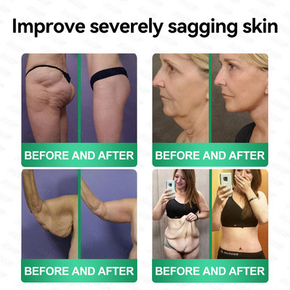 🇺🇸𝑂𝑓𝑓𝑖𝑐𝑖𝑎𝑙 𝑆𝑡𝑜𝑟𝑒 |🌿𝐉𝐎𝑨𝑬® 𝗖𝗼𝗹𝗹𝗮𝗴𝗲𝗻 𝗣𝗲𝗽𝘁𝗶𝗱𝗲𝘀 𝟲-𝗶𝗻-𝟭 𝗛𝗲𝗮𝗹𝘁𝗵 𝗦𝗼𝗹𝘂𝘁𝗶𝗼𝗻 𝗢𝗿𝗮𝗹 𝗟𝗶𝗾𝘂𝗶𝗱✅ 𝒔𝒖𝒑𝒑𝒐𝒓𝒕𝒔 𝒂𝒏𝒕𝒊-𝒂𝒈𝒊𝒏𝒈, 𝒘𝒓𝒊𝒏𝒌𝒍𝒆 𝒓𝒆𝒅𝒖𝒄𝒕𝒊𝒐𝒏, 𝒘𝒂𝒓𝒕 𝒂𝒏𝒅 𝒔𝒑𝒐𝒕 𝒓𝒆𝒎𝒐𝒗𝒂𝒍, 𝒄𝒂𝒓𝒅𝒊𝒐𝒗𝒂𝒔𝒄𝒖𝒍𝒂𝒓 𝒉𝒆𝒂𝒍𝒕𝒉, 𝒊𝒎𝒎𝒖𝒏𝒆 𝒃𝒐𝒐𝒔𝒕, 𝒈𝒖𝒕 𝒃𝒂𝒍𝒂𝒏𝒄𝒆, 𝒋𝒐𝒊𝒏𝒕 𝒄𝒂𝒓𝒆, 𝒂𝒏𝒅 𝒎𝒐𝒓𝒆.