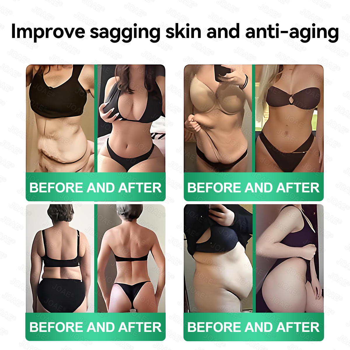 🇺🇸𝑂𝑓𝑓𝑖𝑐𝑖𝑎𝑙 𝑆𝑡𝑜𝑟𝑒 |🌿𝐉𝐎𝑨𝑬® 𝗖𝗼𝗹𝗹𝗮𝗴𝗲𝗻 𝗣𝗲𝗽𝘁𝗶𝗱𝗲𝘀 𝟲-𝗶𝗻-𝟭 𝗛𝗲𝗮𝗹𝘁𝗵 𝗦𝗼𝗹𝘂𝘁𝗶𝗼𝗻 𝗢𝗿𝗮𝗹 𝗟𝗶𝗾𝘂𝗶𝗱✅ 𝒔𝒖𝒑𝒑𝒐𝒓𝒕𝒔 𝒂𝒏𝒕𝒊-𝒂𝒈𝒊𝒏𝒈, 𝒘𝒓𝒊𝒏𝒌𝒍𝒆 𝒓𝒆𝒅𝒖𝒄𝒕𝒊𝒐𝒏, 𝒘𝒂𝒓𝒕 𝒂𝒏𝒅 𝒔𝒑𝒐𝒕 𝒓𝒆𝒎𝒐𝒗𝒂𝒍, 𝒄𝒂𝒓𝒅𝒊𝒐𝒗𝒂𝒔𝒄𝒖𝒍𝒂𝒓 𝒉𝒆𝒂𝒍𝒕𝒉, 𝒊𝒎𝒎𝒖𝒏𝒆 𝒃𝒐𝒐𝒔𝒕, 𝒈𝒖𝒕 𝒃𝒂𝒍𝒂𝒏𝒄𝒆, 𝒋𝒐𝒊𝒏𝒕 𝒄𝒂𝒓𝒆, 𝒂𝒏𝒅 𝒎𝒐𝒓𝒆.