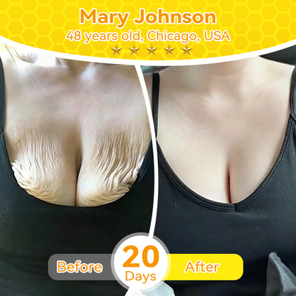 🇺🇸𝑶𝒇𝒇𝒊𝒄𝒊𝒂𝒍 𝑺𝒕𝒐𝒓𝒆|𝑺𝒂𝒃𝒂𝒙® 𝐁𝐞𝐞 𝐕𝐞𝐧𝐨𝐦 & 𝐖𝐡𝐢𝐩𝐩𝐞𝐝 𝐓𝐚𝐥𝐥𝐨𝐰 𝐁𝐚𝐥𝐦 Skin Repair Cream (𝐉𝐮𝐬𝐭 𝐨𝐧𝐜𝐞 𝐚 𝐝𝐚𝐲, 𝐯𝐢𝐬𝐢𝐛𝐥𝐞 𝐜𝐡𝐚𝐧𝐠𝐞𝐬 𝐢𝐧 𝟕 𝐝𝐚𝐲𝐬） ✅ Targets Age Spots, Wrinkles, Eczema, Redness, Stretch Marks, and Even Joint Issues.