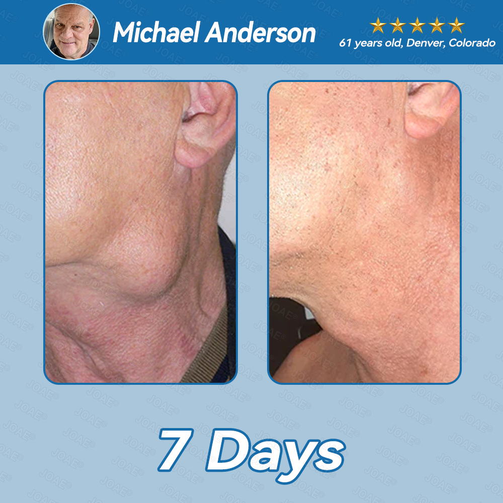 🌿FDA Approved|JOAE® BPC-157 Joint Restore Oral Liquid🦴Treats Arthritis, Neuropathy, Rheumatism, Sports Injuries & More🏆