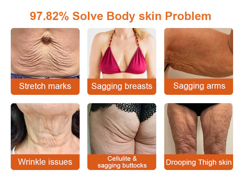 🇺🇸𝑶𝒇𝒇𝒊𝒄𝒊𝒂𝒍 𝑺𝒕𝒐𝒓𝒆|𝑺𝒂𝒃𝒂𝒙® 𝐁𝐞𝐞 𝐕𝐞𝐧𝐨𝐦 & 𝐖𝐡𝐢𝐩𝐩𝐞𝐝 𝐓𝐚𝐥𝐥𝐨𝐰 𝐁𝐚𝐥𝐦 Skin Repair Cream (𝐉𝐮𝐬𝐭 𝐨𝐧𝐜𝐞 𝐚 𝐝𝐚𝐲, 𝐯𝐢𝐬𝐢𝐛𝐥𝐞 𝐜𝐡𝐚𝐧𝐠𝐞𝐬 𝐢𝐧 𝟕 𝐝𝐚𝐲𝐬） ✅ Targets Age Spots, Wrinkles, Eczema, Redness, Stretch Marks, and Even Joint Issues.