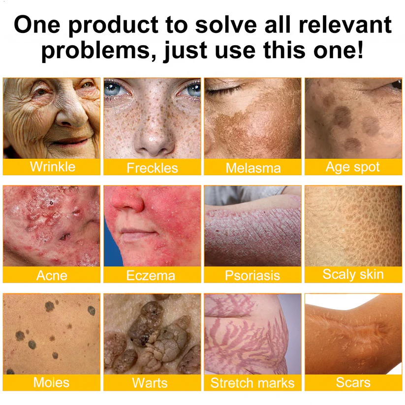 🇺🇸𝑶𝒇𝒇𝒊𝒄𝒊𝒂𝒍 𝑺𝒕𝒐𝒓𝒆|𝑺𝒂𝒃𝒂𝒙® 𝐁𝐞𝐞 𝐕𝐞𝐧𝐨𝐦 & 𝐖𝐡𝐢𝐩𝐩𝐞𝐝 𝐓𝐚𝐥𝐥𝐨𝐰 𝐁𝐚𝐥𝐦 Skin Repair Cream (𝐉𝐮𝐬𝐭 𝐨𝐧𝐜𝐞 𝐚 𝐝𝐚𝐲, 𝐯𝐢𝐬𝐢𝐛𝐥𝐞 𝐜𝐡𝐚𝐧𝐠𝐞𝐬 𝐢𝐧 𝟕 𝐝𝐚𝐲𝐬） ✅ Targets Age Spots, Wrinkles, Eczema, Redness, Stretch Marks, and Even Joint Issues.