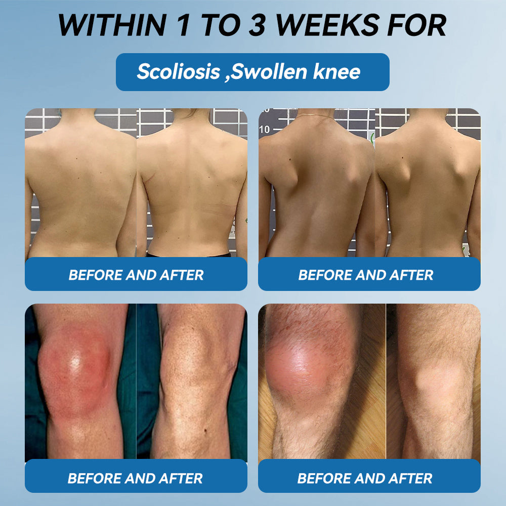 𝐀𝐞𝐞𝙝𝙛𝗲𝗻𝗴® BPC-157 Joint Healing Cream🦴Treats Arthritis, Neuropathy, Rheumatism, Sports Injuries & More 🤍