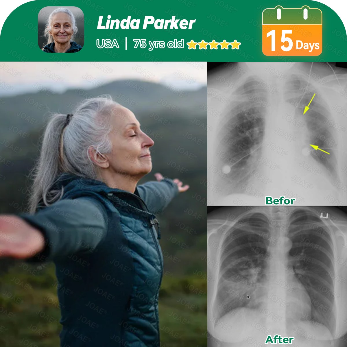 🌿FDA Approved|𝐉𝐎𝑨𝑬®COPD Relief – Mullein Lung Cleanse Oral Liquid(💝 Cough, wheezing, shortness of breath, sputum, stuffy nose, bronchitis, bronchitis, allergy symptoms, lung discomfort🫁)