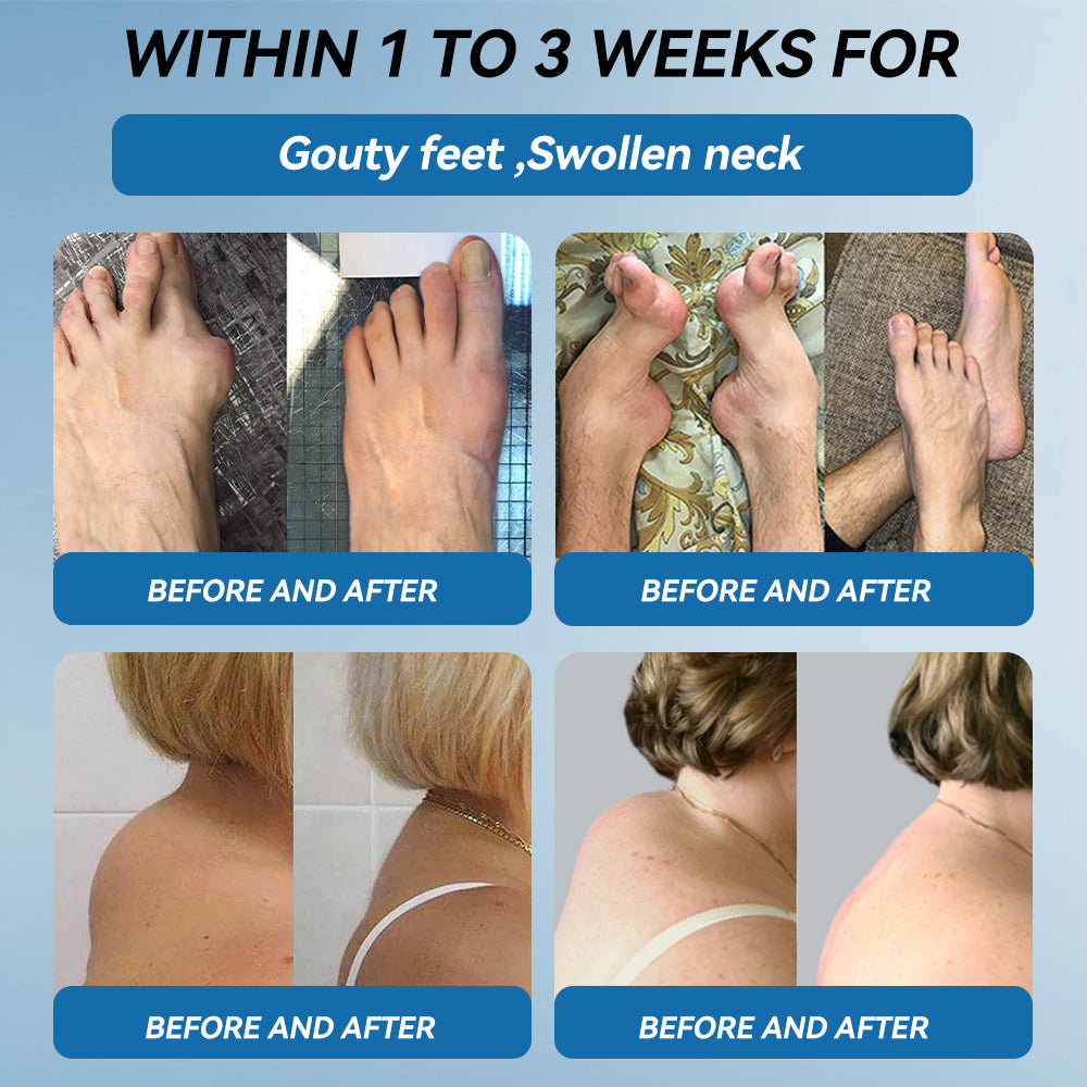 𝐀𝐞𝐞𝙝𝙛𝗲𝗻𝗴® BPC-157 Joint Healing Cream🦴Treats Arthritis, Neuropathy, Rheumatism, Sports Injuries & More 🤍