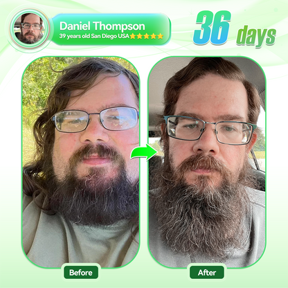 𝑶𝒇𝒇𝒊𝒄𝒊𝒂𝒍 𝑺𝒕𝒐𝒓𝒆 | 𝐇𝐇𝖵𝘽® 𝐺𝐿𝑃-𝟏  All-𝒊𝒏-𝑶𝒏𝒆 Nano Fast-Absorb Oral Spray  (𝐉𝐮𝐬𝐭 𝐨𝐧𝐜𝐞 𝐚 𝐝𝐚𝐲, 𝐯𝐢𝐬𝐢𝐛𝐥𝐞 𝐜𝐡𝐚𝐧𝐠𝐞𝐬 𝐢𝐧 𝟕 𝐝𝐚𝐲𝐬） ✅ 𝐅𝐨𝐫 𝐨𝐛𝐞𝐬𝐢𝐭𝐲, 𝐜𝐚𝐫𝐝𝐢𝐨𝐯𝐚𝐬𝐜𝐮𝐥𝐚𝐫 𝐡𝐞𝐚𝐥𝐭𝐡, 𝐝𝐢𝐚𝐛𝐞𝐭𝐞𝐬, 𝐬𝐥𝐞𝐞𝐩 𝐚𝐩𝐧𝐞𝐚, 𝐆𝐮𝐭 𝐇𝐞𝐚𝐥𝐭𝐡, 𝐣𝐨𝐢𝐧𝐭 𝐢𝐬𝐬𝐮𝐞𝐬, 𝐚𝐧𝐝 𝐦𝐨𝐫𝐞