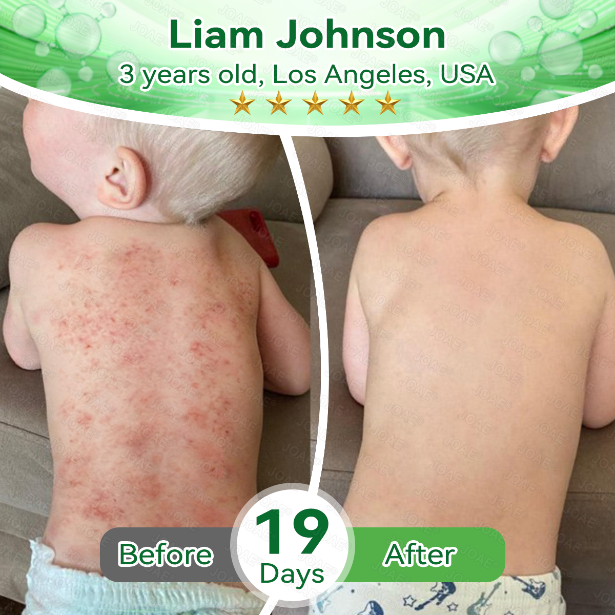 🇺🇸𝑂𝑓𝑓𝑖𝑐𝑖𝑎𝑙 𝑆𝑡𝑜𝑟𝑒 |🌿𝐉𝐎𝑨𝑬® 𝗖𝗼𝗹𝗹𝗮𝗴𝗲𝗻 𝗣𝗲𝗽𝘁𝗶𝗱𝗲𝘀 𝟲-𝗶𝗻-𝟭 𝗛𝗲𝗮𝗹𝘁𝗵 𝗦𝗼𝗹𝘂𝘁𝗶𝗼𝗻 𝗢𝗿𝗮𝗹 𝗟𝗶𝗾𝘂𝗶𝗱✅ 𝒔𝒖𝒑𝒑𝒐𝒓𝒕𝒔 𝒂𝒏𝒕𝒊-𝒂𝒈𝒊𝒏𝒈, 𝒘𝒓𝒊𝒏𝒌𝒍𝒆 𝒓𝒆𝒅𝒖𝒄𝒕𝒊𝒐𝒏, 𝒘𝒂𝒓𝒕 𝒂𝒏𝒅 𝒔𝒑𝒐𝒕 𝒓𝒆𝒎𝒐𝒗𝒂𝒍, 𝒄𝒂𝒓𝒅𝒊𝒐𝒗𝒂𝒔𝒄𝒖𝒍𝒂𝒓 𝒉𝒆𝒂𝒍𝒕𝒉, 𝒊𝒎𝒎𝒖𝒏𝒆 𝒃𝒐𝒐𝒔𝒕, 𝒈𝒖𝒕 𝒃𝒂𝒍𝒂𝒏𝒄𝒆, 𝒋𝒐𝒊𝒏𝒕 𝒄𝒂𝒓𝒆, 𝒂𝒏𝒅 𝒎𝒐𝒓𝒆.