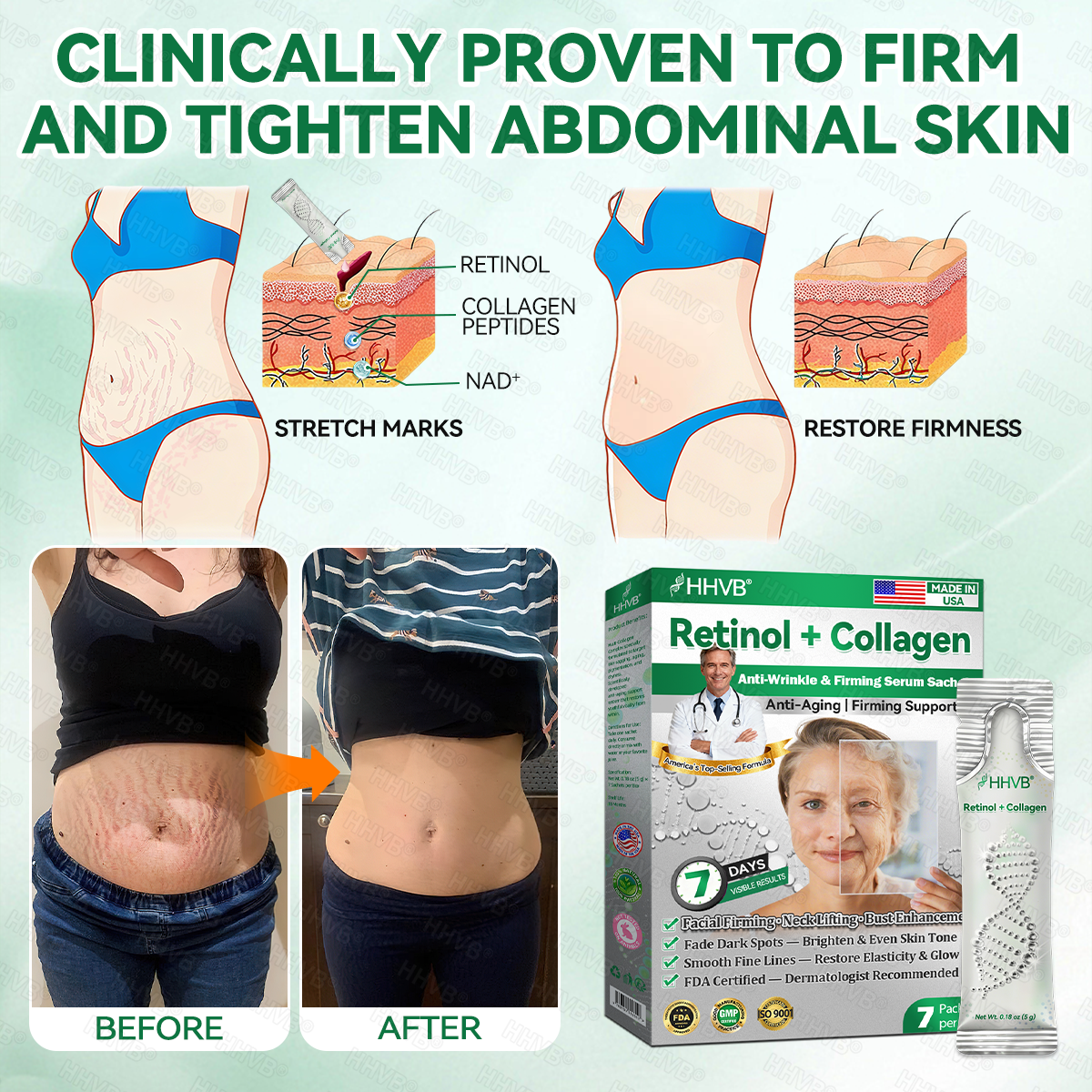 🇺🇸FDA|𝙃𝙃𝙑𝘽®𝐑𝐞𝐭𝐢𝐧𝐨𝐥 + 𝐂𝐨𝐥𝐥𝐚𝐠𝐞𝐧 𝐀𝐧𝐭𝐢-𝐖𝐫𝐢𝐧𝐤𝐥𝐞 & 𝐅𝐢𝐫𝐦𝐢𝐧𝐠 𝐒𝐞𝐫𝐮𝐦 𝐒𝐚𝐜𝐡𝐞𝐭𝐬 (𝐉𝐮𝐬𝐭 𝐨𝐧𝐜𝐞 𝐚 𝐝𝐚𝐲, 𝐯𝐢𝐬𝐢𝐛𝐥𝐞 𝐜𝐡𝐚𝐧𝐠𝐞𝐬 𝐢𝐧 𝟕 𝐝𝐚𝐲𝐬） ✅ Improves sagging skin on the face, neck, arms, abdomen, and buttocks, while reducing dark spots and discoloration