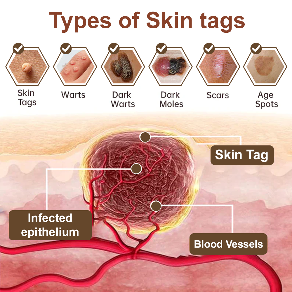 🇺🇸𝑂𝑓𝑓𝑖𝑐𝑖𝑎𝑙 𝑆𝑡𝑜𝑟𝑒 |🌿𝐉𝐎𝑨𝑬® 𝗖𝗼𝗹𝗹𝗮𝗴𝗲𝗻 𝗣𝗲𝗽𝘁𝗶𝗱𝗲𝘀 𝟲-𝗶𝗻-𝟭 𝗛𝗲𝗮𝗹𝘁𝗵 𝗦𝗼𝗹𝘂𝘁𝗶𝗼𝗻 𝗢𝗿𝗮𝗹 𝗟𝗶𝗾𝘂𝗶𝗱✅ 𝒔𝒖𝒑𝒑𝒐𝒓𝒕𝒔 𝒂𝒏𝒕𝒊-𝒂𝒈𝒊𝒏𝒈, 𝒘𝒓𝒊𝒏𝒌𝒍𝒆 𝒓𝒆𝒅𝒖𝒄𝒕𝒊𝒐𝒏, 𝒘𝒂𝒓𝒕 𝒂𝒏𝒅 𝒔𝒑𝒐𝒕 𝒓𝒆𝒎𝒐𝒗𝒂𝒍, 𝒄𝒂𝒓𝒅𝒊𝒐𝒗𝒂𝒔𝒄𝒖𝒍𝒂𝒓 𝒉𝒆𝒂𝒍𝒕𝒉, 𝒊𝒎𝒎𝒖𝒏𝒆 𝒃𝒐𝒐𝒔𝒕, 𝒈𝒖𝒕 𝒃𝒂𝒍𝒂𝒏𝒄𝒆, 𝒋𝒐𝒊𝒏𝒕 𝒄𝒂𝒓𝒆, 𝒂𝒏𝒅 𝒎𝒐𝒓𝒆.