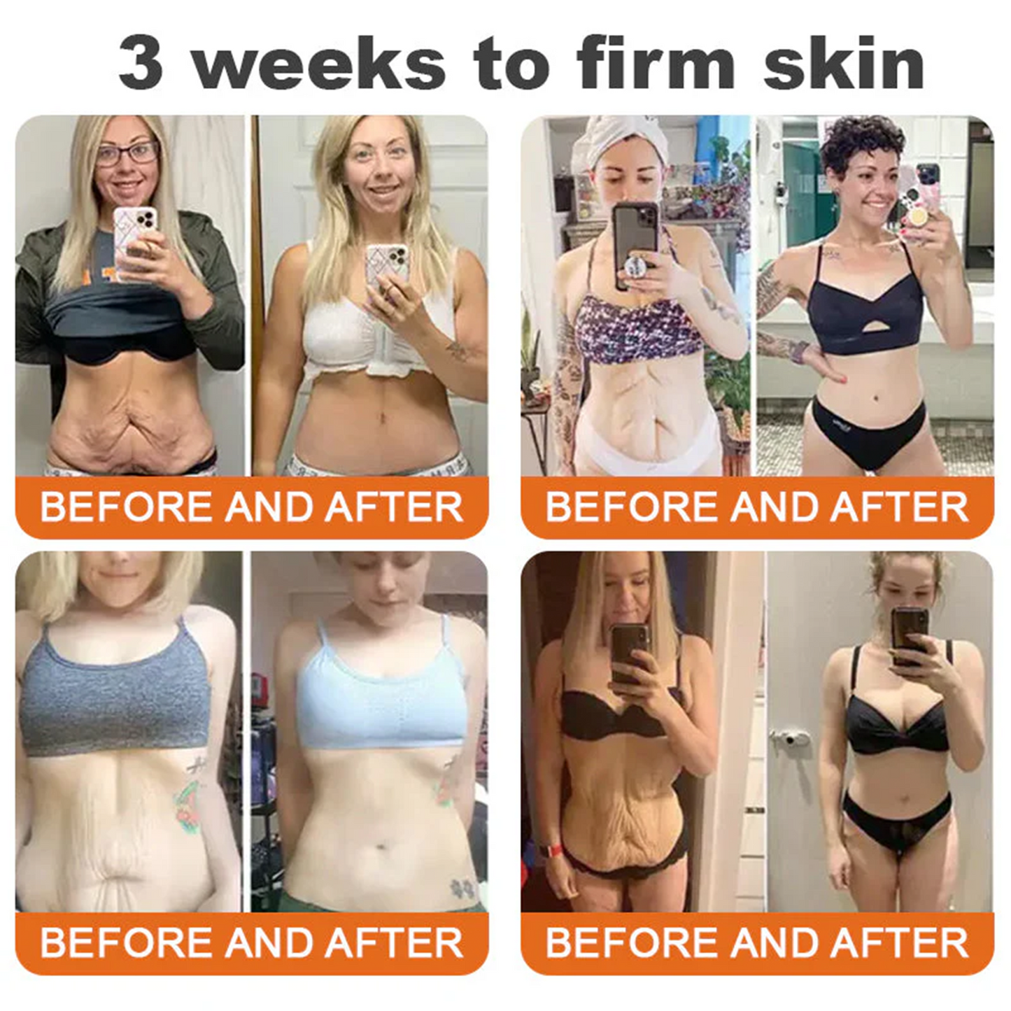 🇺🇸𝑶𝒇𝒇𝒊𝒄𝒊𝒂𝒍 𝑺𝒕𝒐𝒓𝒆|𝑺𝒂𝒃𝒂𝒙® 𝐁𝐞𝐞 𝐕𝐞𝐧𝐨𝐦 & 𝐖𝐡𝐢𝐩𝐩𝐞𝐝 𝐓𝐚𝐥𝐥𝐨𝐰 𝐁𝐚𝐥𝐦 Skin Repair Cream (𝐉𝐮𝐬𝐭 𝐨𝐧𝐜𝐞 𝐚 𝐝𝐚𝐲, 𝐯𝐢𝐬𝐢𝐛𝐥𝐞 𝐜𝐡𝐚𝐧𝐠𝐞𝐬 𝐢𝐧 𝟕 𝐝𝐚𝐲𝐬） ✅ Targets Age Spots, Wrinkles, Eczema, Redness, Stretch Marks, and Even Joint Issues.