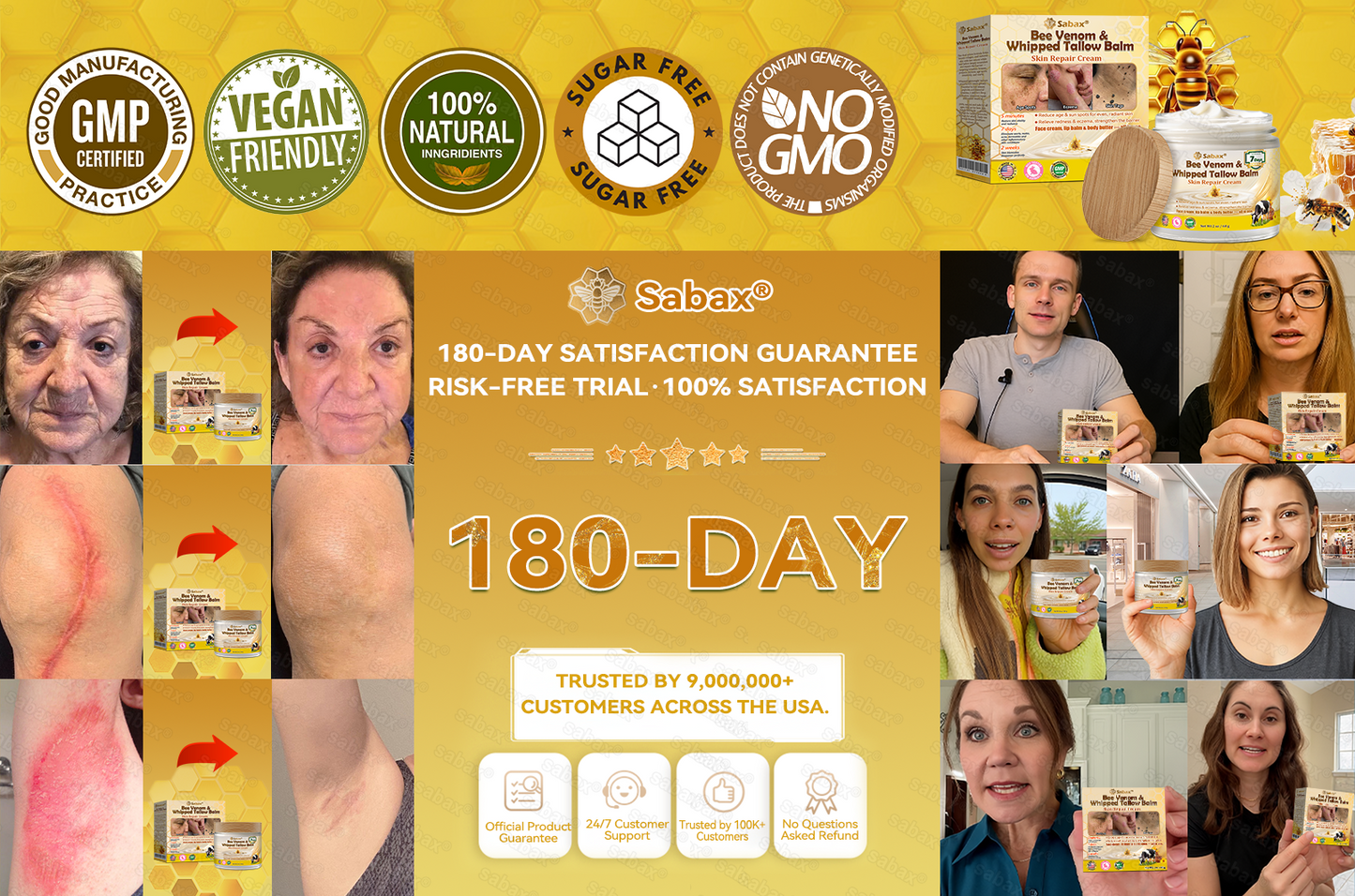 🇺🇸𝑶𝒇𝒇𝒊𝒄𝒊𝒂𝒍 𝑺𝒕𝒐𝒓𝒆|𝑺𝒂𝒃𝒂𝒙® 𝐁𝐞𝐞 𝐕𝐞𝐧𝐨𝐦 & 𝐖𝐡𝐢𝐩𝐩𝐞𝐝 𝐓𝐚𝐥𝐥𝐨𝐰 𝐁𝐚𝐥𝐦 Skin Repair Cream (𝐉𝐮𝐬𝐭 𝐨𝐧𝐜𝐞 𝐚 𝐝𝐚𝐲, 𝐯𝐢𝐬𝐢𝐛𝐥𝐞 𝐜𝐡𝐚𝐧𝐠𝐞𝐬 𝐢𝐧 𝟕 𝐝𝐚𝐲𝐬） ✅ Targets Age Spots, Wrinkles, Eczema, Redness, Stretch Marks, and Even Joint Issues.