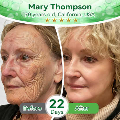 🇺🇸𝑂𝑓𝑓𝑖𝑐𝑖𝑎𝑙 𝑆𝑡𝑜𝑟𝑒 |🌿𝐉𝐎𝑨𝑬® 𝗖𝗼𝗹𝗹𝗮𝗴𝗲𝗻 𝗣𝗲𝗽𝘁𝗶𝗱𝗲𝘀 𝟲-𝗶𝗻-𝟭 𝗛𝗲𝗮𝗹𝘁𝗵 𝗦𝗼𝗹𝘂𝘁𝗶𝗼𝗻 𝗢𝗿𝗮𝗹 𝗟𝗶𝗾𝘂𝗶𝗱✅ 𝒔𝒖𝒑𝒑𝒐𝒓𝒕𝒔 𝒂𝒏𝒕𝒊-𝒂𝒈𝒊𝒏𝒈, 𝒘𝒓𝒊𝒏𝒌𝒍𝒆 𝒓𝒆𝒅𝒖𝒄𝒕𝒊𝒐𝒏, 𝒘𝒂𝒓𝒕 𝒂𝒏𝒅 𝒔𝒑𝒐𝒕 𝒓𝒆𝒎𝒐𝒗𝒂𝒍, 𝒄𝒂𝒓𝒅𝒊𝒐𝒗𝒂𝒔𝒄𝒖𝒍𝒂𝒓 𝒉𝒆𝒂𝒍𝒕𝒉, 𝒊𝒎𝒎𝒖𝒏𝒆 𝒃𝒐𝒐𝒔𝒕, 𝒈𝒖𝒕 𝒃𝒂𝒍𝒂𝒏𝒄𝒆, 𝒋𝒐𝒊𝒏𝒕 𝒄𝒂𝒓𝒆, 𝒂𝒏𝒅 𝒎𝒐𝒓𝒆.