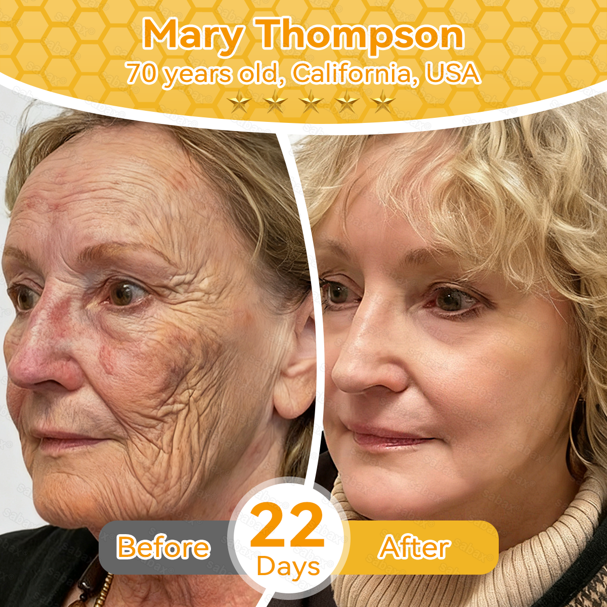 🇺🇸𝑶𝒇𝒇𝒊𝒄𝒊𝒂𝒍 𝑺𝒕𝒐𝒓𝒆|𝑺𝒂𝒃𝒂𝒙® 𝐁𝐞𝐞 𝐕𝐞𝐧𝐨𝐦 & 𝐖𝐡𝐢𝐩𝐩𝐞𝐝 𝐓𝐚𝐥𝐥𝐨𝐰 𝐁𝐚𝐥𝐦 Skin Repair Cream (𝐉𝐮𝐬𝐭 𝐨𝐧𝐜𝐞 𝐚 𝐝𝐚𝐲, 𝐯𝐢𝐬𝐢𝐛𝐥𝐞 𝐜𝐡𝐚𝐧𝐠𝐞𝐬 𝐢𝐧 𝟕 𝐝𝐚𝐲𝐬） ✅ Targets Age Spots, Wrinkles, Eczema, Redness, Stretch Marks, and Even Joint Issues.