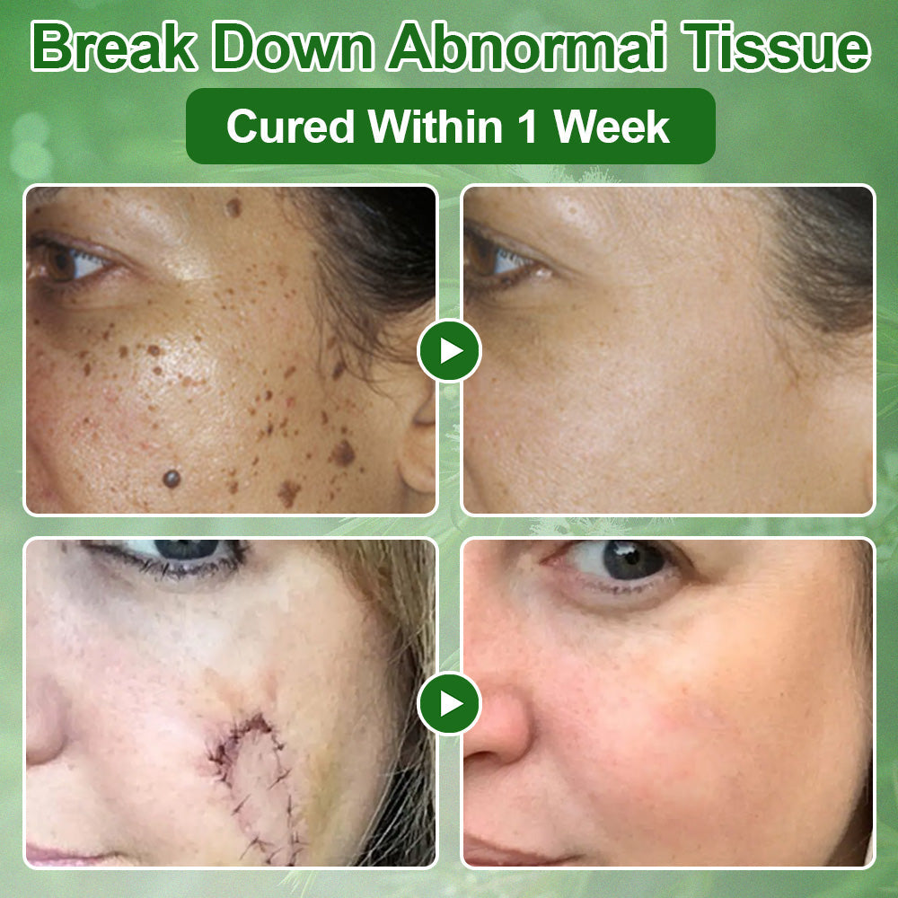 🇺🇸𝑂𝑓𝑓𝑖𝑐𝑖𝑎𝑙 𝑆𝑡𝑜𝑟𝑒 |🌿𝐉𝐎𝑨𝑬® 𝗖𝗼𝗹𝗹𝗮𝗴𝗲𝗻 𝗣𝗲𝗽𝘁𝗶𝗱𝗲𝘀 𝟲-𝗶𝗻-𝟭 𝗛𝗲𝗮𝗹𝘁𝗵 𝗦𝗼𝗹𝘂𝘁𝗶𝗼𝗻 𝗢𝗿𝗮𝗹 𝗟𝗶𝗾𝘂𝗶𝗱✅ 𝒔𝒖𝒑𝒑𝒐𝒓𝒕𝒔 𝒂𝒏𝒕𝒊-𝒂𝒈𝒊𝒏𝒈, 𝒘𝒓𝒊𝒏𝒌𝒍𝒆 𝒓𝒆𝒅𝒖𝒄𝒕𝒊𝒐𝒏, 𝒘𝒂𝒓𝒕 𝒂𝒏𝒅 𝒔𝒑𝒐𝒕 𝒓𝒆𝒎𝒐𝒗𝒂𝒍, 𝒄𝒂𝒓𝒅𝒊𝒐𝒗𝒂𝒔𝒄𝒖𝒍𝒂𝒓 𝒉𝒆𝒂𝒍𝒕𝒉, 𝒊𝒎𝒎𝒖𝒏𝒆 𝒃𝒐𝒐𝒔𝒕, 𝒈𝒖𝒕 𝒃𝒂𝒍𝒂𝒏𝒄𝒆, 𝒋𝒐𝒊𝒏𝒕 𝒄𝒂𝒓𝒆, 𝒂𝒏𝒅 𝒎𝒐𝒓𝒆.