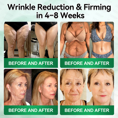 🇺🇸FDA|𝙃𝙃𝙑𝘽®𝐑𝐞𝐭𝐢𝐧𝐨𝐥 + 𝐂𝐨𝐥𝐥𝐚𝐠𝐞𝐧 𝐀𝐧𝐭𝐢-𝐖𝐫𝐢𝐧𝐤𝐥𝐞 & 𝐅𝐢𝐫𝐦𝐢𝐧𝐠 𝐒𝐞𝐫𝐮𝐦 𝐒𝐚𝐜𝐡𝐞𝐭𝐬 (𝐉𝐮𝐬𝐭 𝐨𝐧𝐜𝐞 𝐚 𝐝𝐚𝐲, 𝐯𝐢𝐬𝐢𝐛𝐥𝐞 𝐜𝐡𝐚𝐧𝐠𝐞𝐬 𝐢𝐧 𝟕 𝐝𝐚𝐲𝐬） ✅ Improves sagging skin on the face, neck, arms, abdomen, and buttocks, while reducing dark spots and discoloration