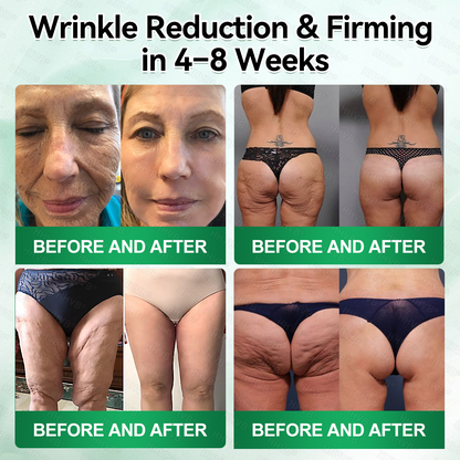 🇺🇸FDA|𝙃𝙃𝙑𝘽®𝐑𝐞𝐭𝐢𝐧𝐨𝐥 + 𝐂𝐨𝐥𝐥𝐚𝐠𝐞𝐧 𝐀𝐧𝐭𝐢-𝐖𝐫𝐢𝐧𝐤𝐥𝐞 & 𝐅𝐢𝐫𝐦𝐢𝐧𝐠 𝐒𝐞𝐫𝐮𝐦 𝐒𝐚𝐜𝐡𝐞𝐭𝐬 (𝐉𝐮𝐬𝐭 𝐨𝐧𝐜𝐞 𝐚 𝐝𝐚𝐲, 𝐯𝐢𝐬𝐢𝐛𝐥𝐞 𝐜𝐡𝐚𝐧𝐠𝐞𝐬 𝐢𝐧 𝟕 𝐝𝐚𝐲𝐬） ✅ Improves sagging skin on the face, neck, arms, abdomen, and buttocks, while reducing dark spots and discoloration