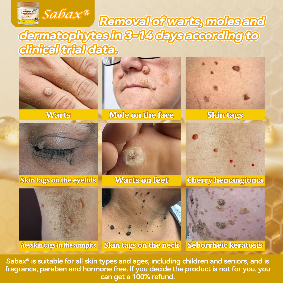 🇺🇸𝑶𝒇𝒇𝒊𝒄𝒊𝒂𝒍 𝑺𝒕𝒐𝒓𝒆|𝑺𝒂𝒃𝒂𝒙® 𝐁𝐞𝐞 𝐕𝐞𝐧𝐨𝐦 & 𝐖𝐡𝐢𝐩𝐩𝐞𝐝 𝐓𝐚𝐥𝐥𝐨𝐰 𝐁𝐚𝐥𝐦 Skin Repair Cream (𝐉𝐮𝐬𝐭 𝐨𝐧𝐜𝐞 𝐚 𝐝𝐚𝐲, 𝐯𝐢𝐬𝐢𝐛𝐥𝐞 𝐜𝐡𝐚𝐧𝐠𝐞𝐬 𝐢𝐧 𝟕 𝐝𝐚𝐲𝐬） ✅ Targets Age Spots, Wrinkles, Eczema, Redness, Stretch Marks, and Even Joint Issues.