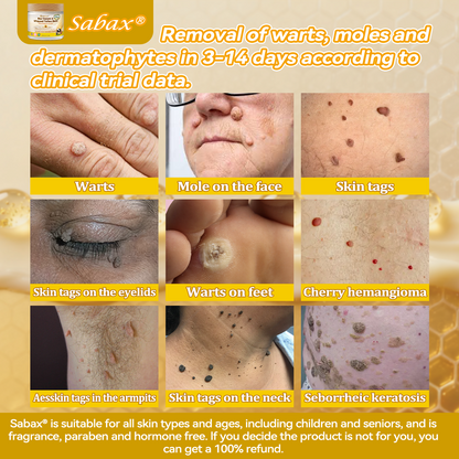 🇺🇸𝑶𝒇𝒇𝒊𝒄𝒊𝒂𝒍 𝑺𝒕𝒐𝒓𝒆|𝑺𝒂𝒃𝒂𝒙® 𝐁𝐞𝐞 𝐕𝐞𝐧𝐨𝐦 & 𝐖𝐡𝐢𝐩𝐩𝐞𝐝 𝐓𝐚𝐥𝐥𝐨𝐰 𝐁𝐚𝐥𝐦 Skin Repair Cream (𝐉𝐮𝐬𝐭 𝐨𝐧𝐜𝐞 𝐚 𝐝𝐚𝐲, 𝐯𝐢𝐬𝐢𝐛𝐥𝐞 𝐜𝐡𝐚𝐧𝐠𝐞𝐬 𝐢𝐧 𝟕 𝐝𝐚𝐲𝐬） ✅ Targets Age Spots, Wrinkles, Eczema, Redness, Stretch Marks, and Even Joint Issues.