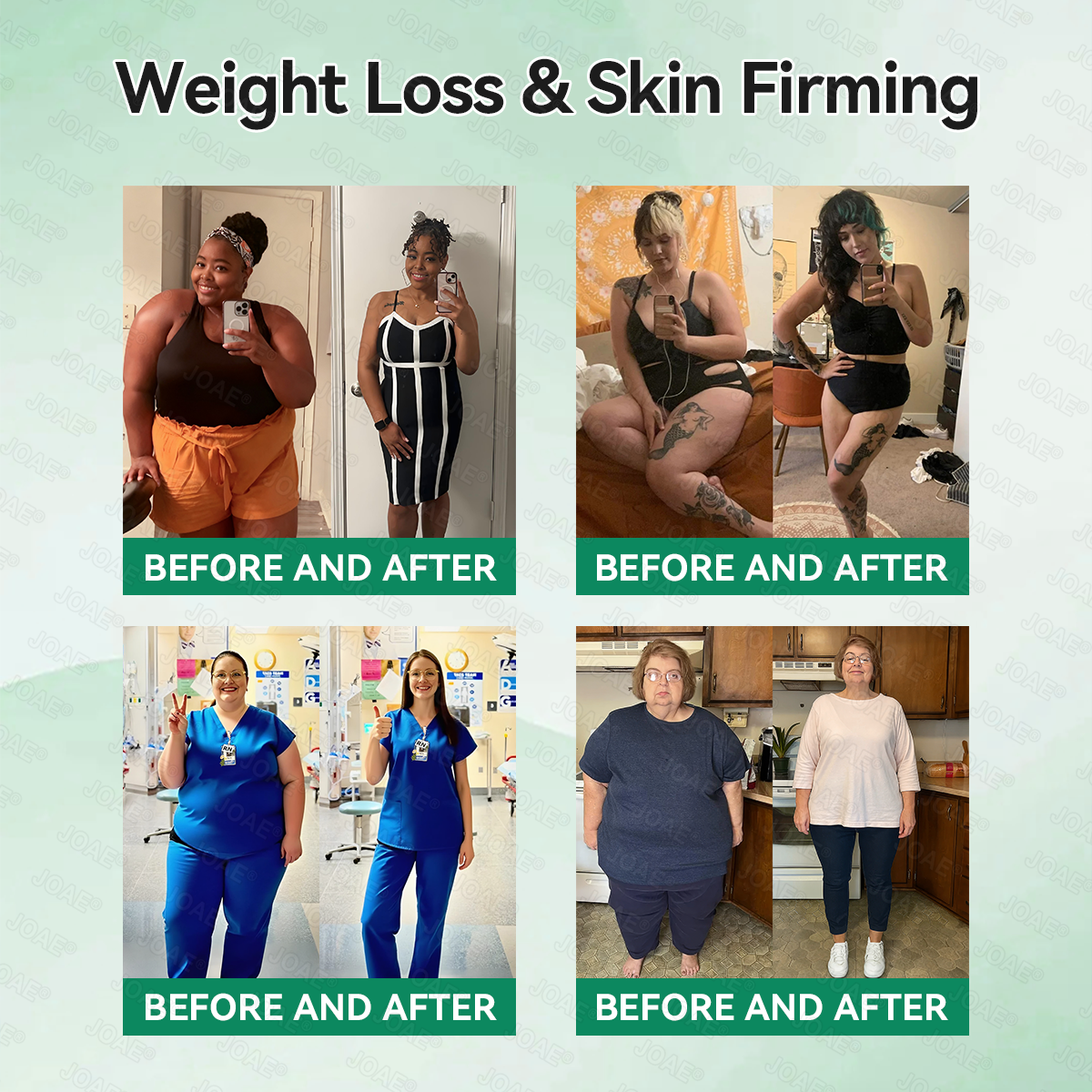 𝐎𝐟𝐟𝐢𝐜𝐢𝐚𝐥 𝐒𝐭𝐨𝐫𝐞| 🎁𝐉𝐎𝐀𝐄® 𝐆𝐋𝐏-𝟏 𝐒𝐥𝐢𝐦 & 𝐆𝐮𝐭 𝐏𝐫𝐨𝐛𝐢𝐨𝐭𝐢𝐜 𝐏𝐨𝐰𝐝𝐞𝐫 (𝐆𝐋𝐏-𝟏 × 𝐏𝐫𝐨𝐛𝐢𝐨𝐭𝐢𝐜 × 𝐀𝐂𝐕) — 𝐃𝐞𝐬𝐢𝐠𝐧𝐞𝐝 𝐟𝐨𝐫 𝐖𝐞𝐢𝐠𝐡𝐭 𝐌𝐚𝐧𝐚𝐠𝐞𝐦𝐞𝐧𝐭, 𝐆𝐮𝐭 𝐇𝐞𝐚𝐥𝐭𝐡, 𝐁𝐥𝐨𝐨𝐝 𝐒𝐮𝐠𝐚𝐫 𝐒𝐮𝐩𝐩𝐨𝐫𝐭, 𝐁𝐥𝐨𝐚𝐭𝐢𝐧𝐠 & 𝐂𝐨𝐧𝐬𝐭𝐢𝐩𝐚𝐭𝐢𝐨𝐧 𝐑𝐞𝐥𝐢𝐞𝐟, 𝐀𝐩𝐩𝐞𝐭𝐢𝐭𝐞 𝐂𝐨𝐧𝐭𝐫𝐨𝐥, 𝐈𝐦𝐦𝐮𝐧𝐢𝐭𝐲, 𝐚𝐧𝐝 𝐄𝐧𝐞𝐫𝐠𝐲 𝐁𝐨𝐨𝐬𝐭