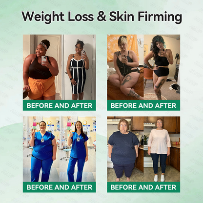 𝐎𝐟𝐟𝐢𝐜𝐢𝐚𝐥 𝐒𝐭𝐨𝐫𝐞| 🎁𝐉𝐎𝐀𝐄® 𝐆𝐋𝐏-𝟏 𝐒𝐥𝐢𝐦 & 𝐆𝐮𝐭 𝐏𝐫𝐨𝐛𝐢𝐨𝐭𝐢𝐜 𝐏𝐨𝐰𝐝𝐞𝐫 (𝐆𝐋𝐏-𝟏 × 𝐏𝐫𝐨𝐛𝐢𝐨𝐭𝐢𝐜 × 𝐀𝐂𝐕) — 𝐃𝐞𝐬𝐢𝐠𝐧𝐞𝐝 𝐟𝐨𝐫 𝐖𝐞𝐢𝐠𝐡𝐭 𝐌𝐚𝐧𝐚𝐠𝐞𝐦𝐞𝐧𝐭, 𝐆𝐮𝐭 𝐇𝐞𝐚𝐥𝐭𝐡, 𝐁𝐥𝐨𝐨𝐝 𝐒𝐮𝐠𝐚𝐫 𝐒𝐮𝐩𝐩𝐨𝐫𝐭, 𝐁𝐥𝐨𝐚𝐭𝐢𝐧𝐠 & 𝐂𝐨𝐧𝐬𝐭𝐢𝐩𝐚𝐭𝐢𝐨𝐧 𝐑𝐞𝐥𝐢𝐞𝐟, 𝐀𝐩𝐩𝐞𝐭𝐢𝐭𝐞 𝐂𝐨𝐧𝐭𝐫𝐨𝐥, 𝐈𝐦𝐦𝐮𝐧𝐢𝐭𝐲, 𝐚𝐧𝐝 𝐄𝐧𝐞𝐫𝐠𝐲 𝐁𝐨𝐨𝐬𝐭