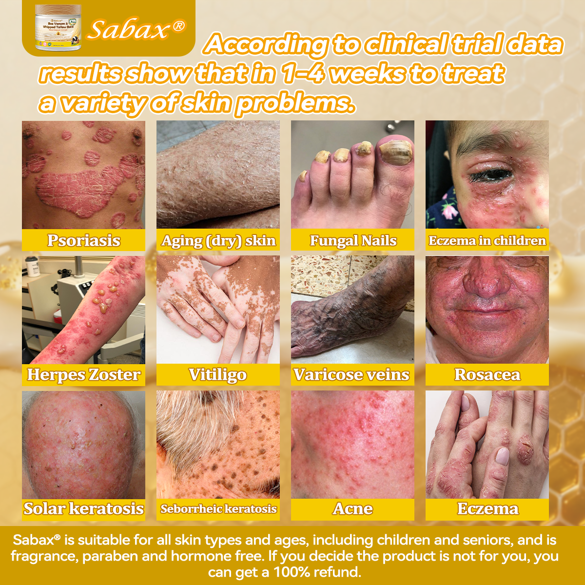 🇺🇸𝑶𝒇𝒇𝒊𝒄𝒊𝒂𝒍 𝑺𝒕𝒐𝒓𝒆|𝑺𝒂𝒃𝒂𝒙® 𝐁𝐞𝐞 𝐕𝐞𝐧𝐨𝐦 & 𝐖𝐡𝐢𝐩𝐩𝐞𝐝 𝐓𝐚𝐥𝐥𝐨𝐰 𝐁𝐚𝐥𝐦 Skin Repair Cream (𝐉𝐮𝐬𝐭 𝐨𝐧𝐜𝐞 𝐚 𝐝𝐚𝐲, 𝐯𝐢𝐬𝐢𝐛𝐥𝐞 𝐜𝐡𝐚𝐧𝐠𝐞𝐬 𝐢𝐧 𝟕 𝐝𝐚𝐲𝐬） ✅ Targets Age Spots, Wrinkles, Eczema, Redness, Stretch Marks, and Even Joint Issues.