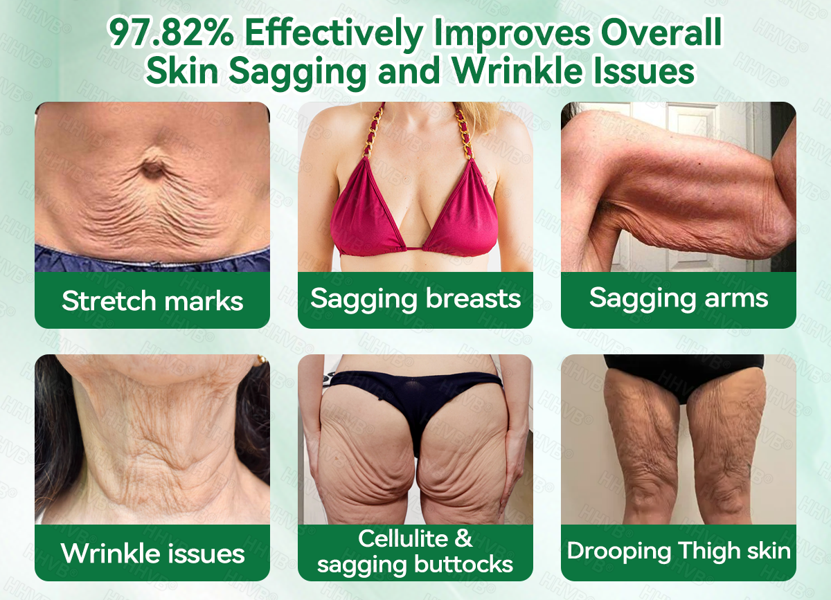 🇺🇸FDA|𝙃𝙃𝙑𝘽®𝐑𝐞𝐭𝐢𝐧𝐨𝐥 + 𝐂𝐨𝐥𝐥𝐚𝐠𝐞𝐧 𝐀𝐧𝐭𝐢-𝐖𝐫𝐢𝐧𝐤𝐥𝐞 & 𝐅𝐢𝐫𝐦𝐢𝐧𝐠 𝐒𝐞𝐫𝐮𝐦 𝐒𝐚𝐜𝐡𝐞𝐭𝐬 (𝐉𝐮𝐬𝐭 𝐨𝐧𝐜𝐞 𝐚 𝐝𝐚𝐲, 𝐯𝐢𝐬𝐢𝐛𝐥𝐞 𝐜𝐡𝐚𝐧𝐠𝐞𝐬 𝐢𝐧 𝟕 𝐝𝐚𝐲𝐬） ✅ Improves sagging skin on the face, neck, arms, abdomen, and buttocks, while reducing dark spots and discoloration