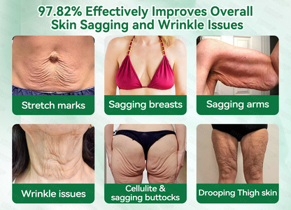 🇺🇸FDA|𝙃𝙃𝙑𝘽®𝐑𝐞𝐭𝐢𝐧𝐨𝐥 + 𝐂𝐨𝐥𝐥𝐚𝐠𝐞𝐧 𝐀𝐧𝐭𝐢-𝐖𝐫𝐢𝐧𝐤𝐥𝐞 & 𝐅𝐢𝐫𝐦𝐢𝐧𝐠 𝐒𝐞𝐫𝐮𝐦 𝐒𝐚𝐜𝐡𝐞𝐭𝐬 (𝐉𝐮𝐬𝐭 𝐨𝐧𝐜𝐞 𝐚 𝐝𝐚𝐲, 𝐯𝐢𝐬𝐢𝐛𝐥𝐞 𝐜𝐡𝐚𝐧𝐠𝐞𝐬 𝐢𝐧 𝟕 𝐝𝐚𝐲𝐬） ✅ Improves sagging skin on the face, neck, arms, abdomen, and buttocks, while reducing dark spots and discoloration