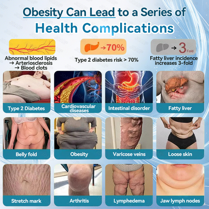 𝑶𝒇𝒇𝒊𝒄𝒊𝒂𝒍 𝑺𝒕𝒐𝒓𝒆  | 🎁🎁𝐉𝐎𝐀𝐄® 𝐑𝐞𝐭𝐚𝐭𝐫𝐮𝐭𝐢𝐝𝐞 𝐆𝐋𝐏-𝟏 𝐓𝐫𝐢𝐩𝐥𝐞-𝐀𝐠𝐨𝐧𝐢𝐬𝐭 𝐌𝐮𝐥𝐭𝐢-𝐅𝐮𝐧𝐜𝐭𝐢𝐨𝐧 𝐎𝐫𝐚𝐥 𝐒𝐨𝐥𝐮𝐭𝐢𝐨𝐧𝐧 (𝐍𝐞𝐱𝐭-𝐆𝐞𝐧𝐞𝐫𝐚𝐭𝐢𝐨𝐧 𝐆𝐋𝐏-𝟏 × 𝐆𝐈𝐏 × 𝐆𝐂𝐆 𝐀𝐠𝐨𝐧𝐢𝐬𝐭） ✅ 𝐅𝐨𝐫 𝐨𝐛𝐞𝐬𝐢𝐭𝐲, 𝐜𝐚𝐫𝐝𝐢𝐨𝐯𝐚𝐬𝐜𝐮𝐥𝐚𝐫 𝐡𝐞𝐚𝐥𝐭𝐡, 𝐝𝐢𝐚𝐛𝐞𝐭𝐞𝐬, 𝐬𝐥𝐞𝐞𝐩 𝐚𝐩𝐧𝐞𝐚, 𝐣𝐨𝐢𝐧𝐭 𝐢𝐬𝐬𝐮𝐞𝐬, 𝐚𝐧𝐝 𝐦𝐨𝐫𝐞